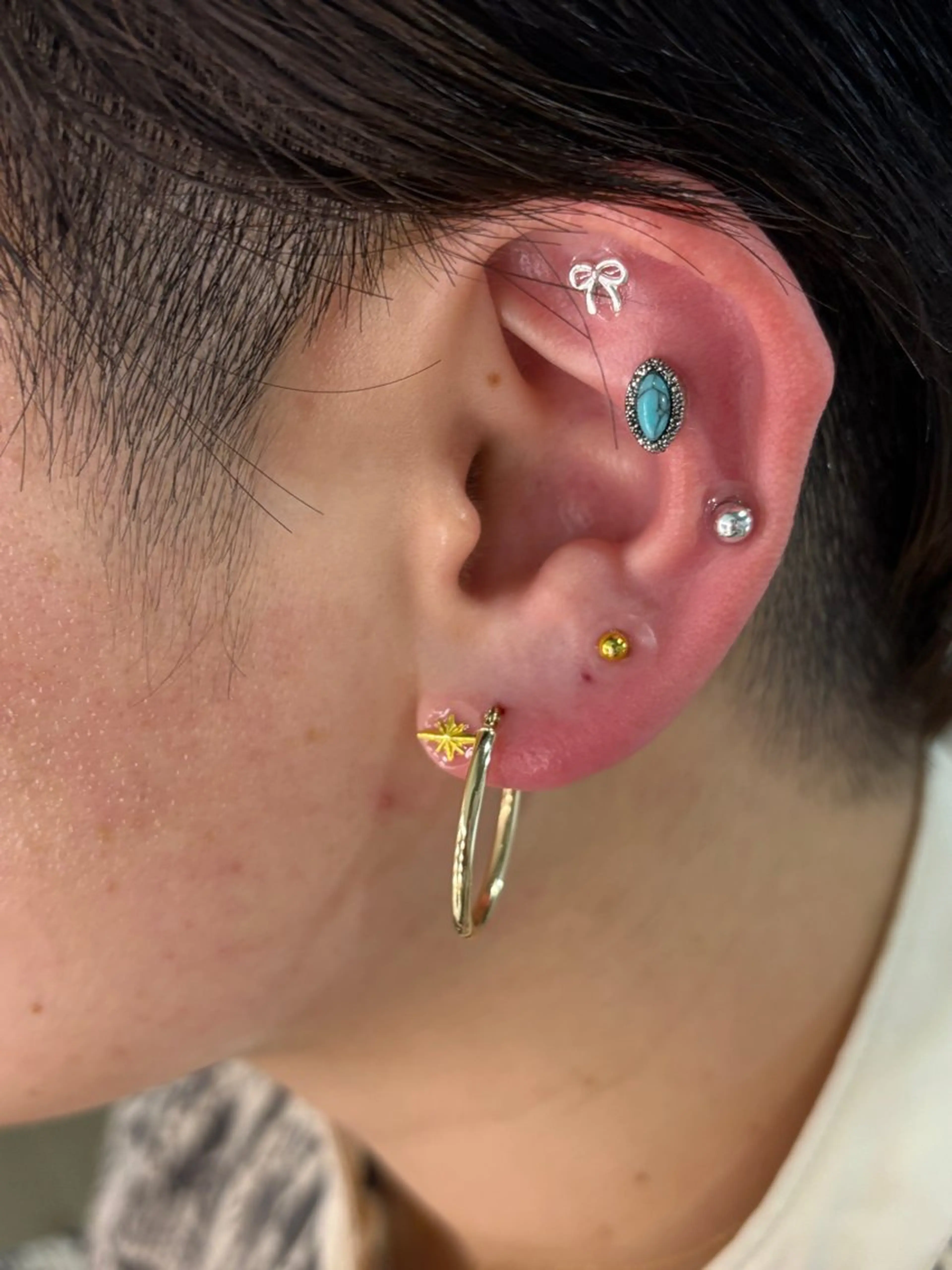 その他 肌質改善サロンand...所属・肌質改善サロン and...のエステ・リラクイメージ