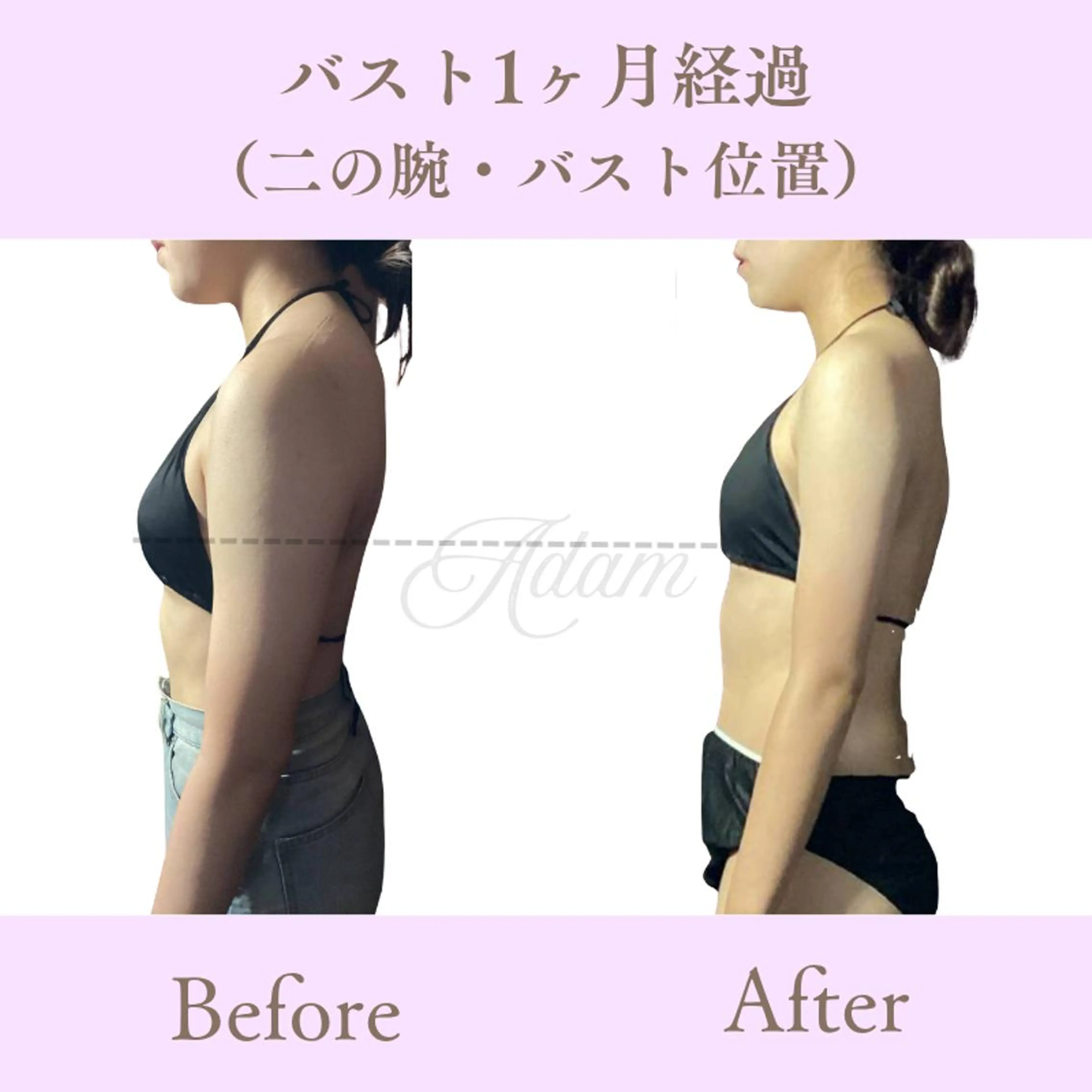 エステ リラク Adam 上半身美人のエステ・リラクイメージ