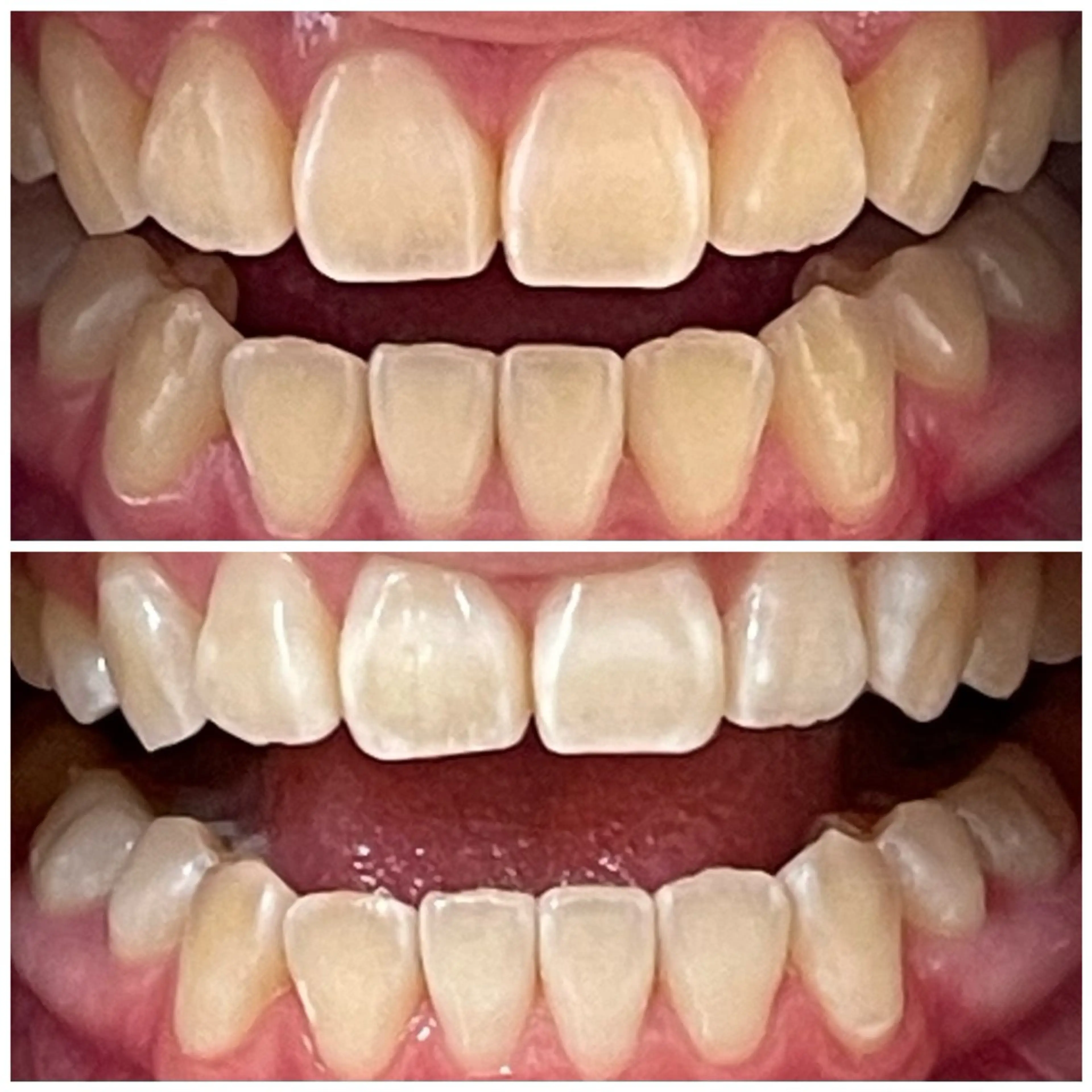 DIAMOND BEAUYのその他イメージ