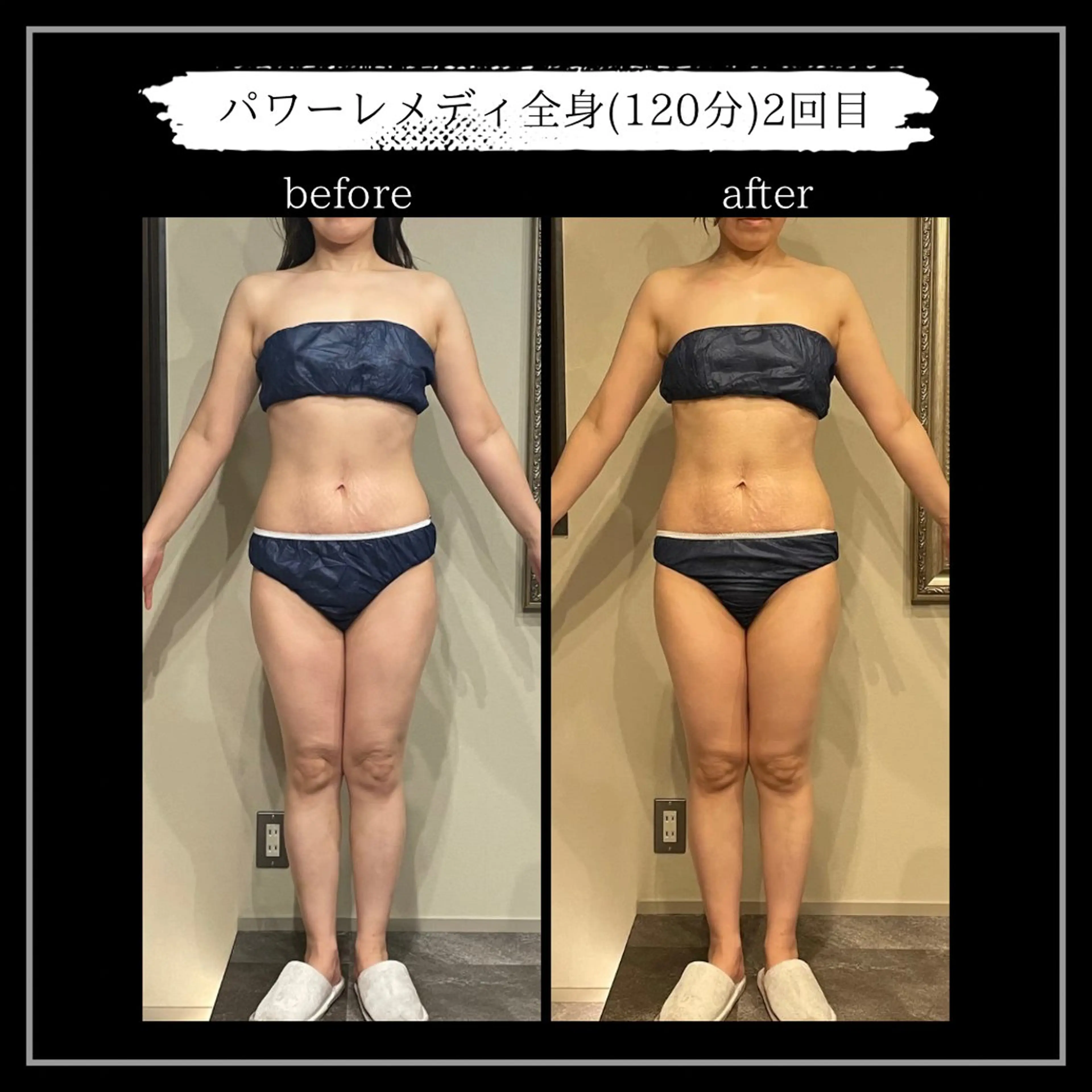 オフ:オン 全身筋膜マッサージのエステ・リラクイメージ