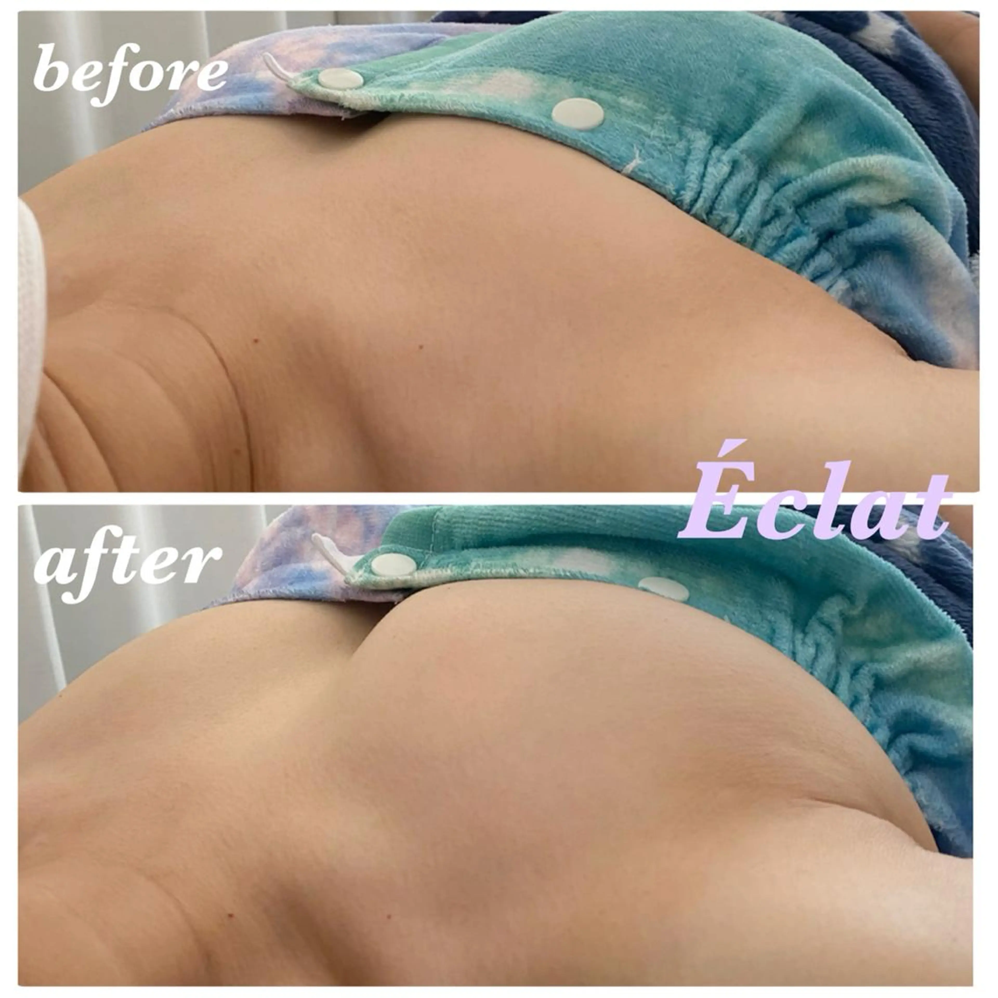 バストアップ💗二の腕・背中からスッキリ🫣✨オールハンド施術の写真