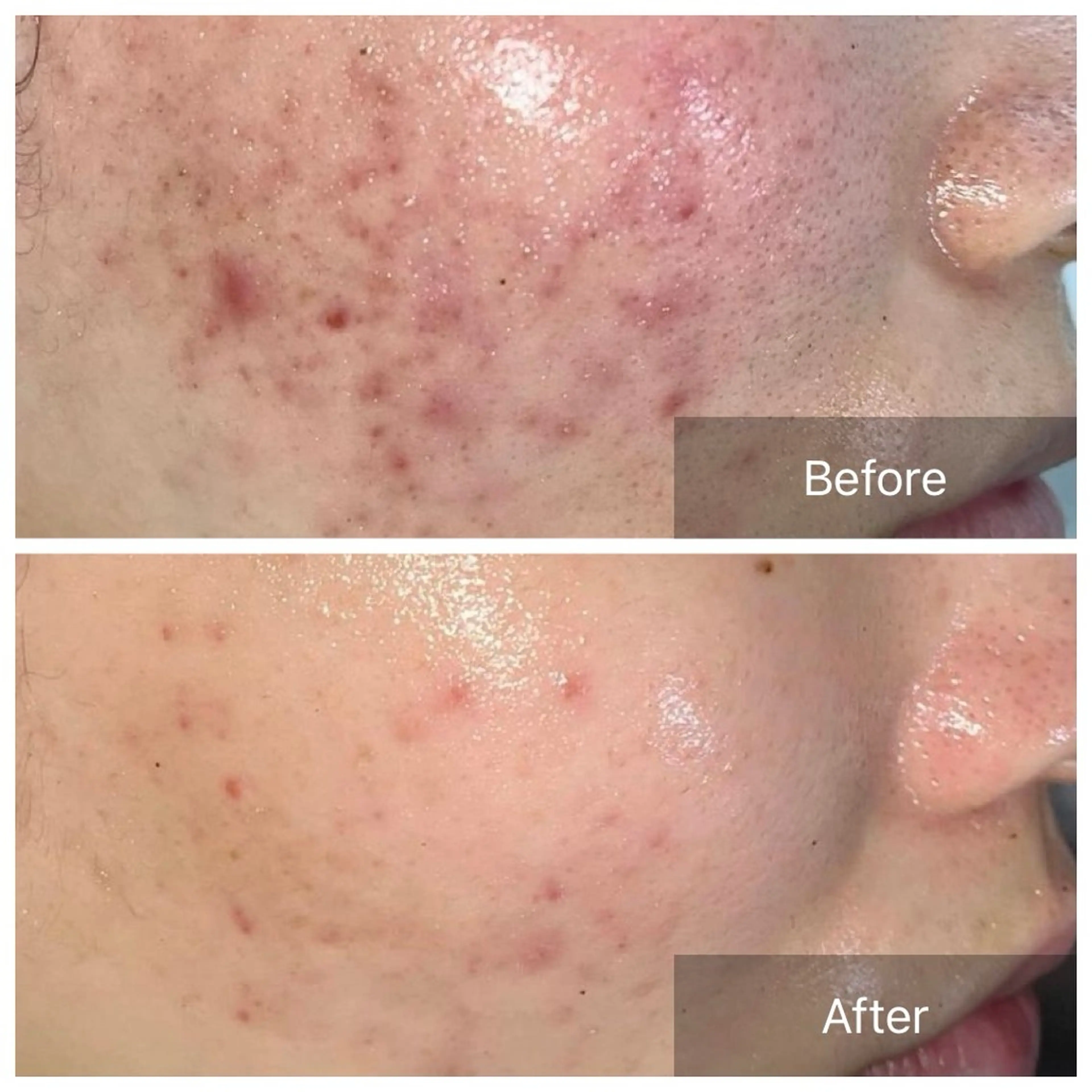 エステ 【現役看護師】高来 笑子のエステ・リラクイメージ