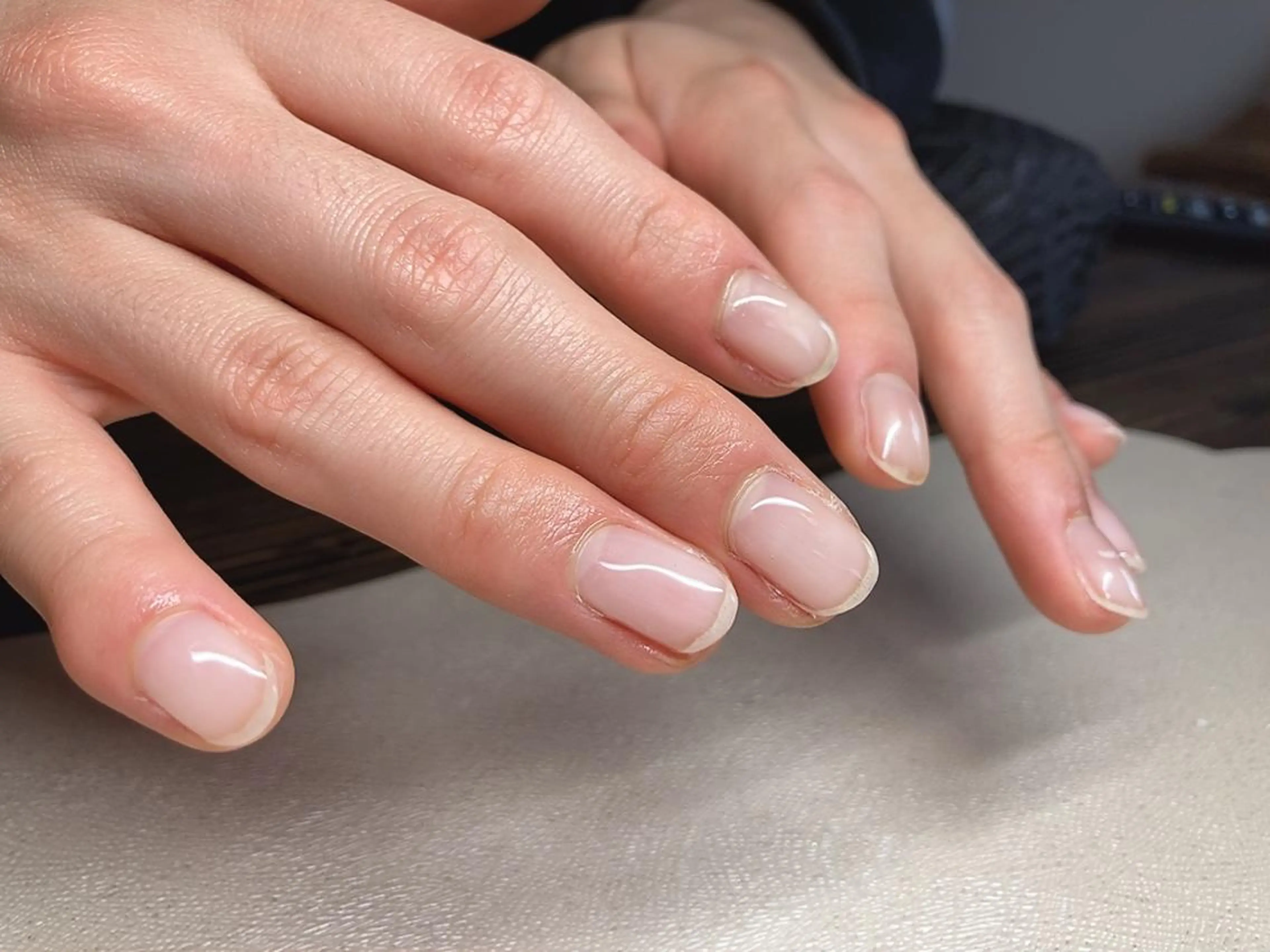 ネイル ハンドネイル 𝐴𝑁𝑈𝐸 トラブル爪育成専門のネイルデザイン