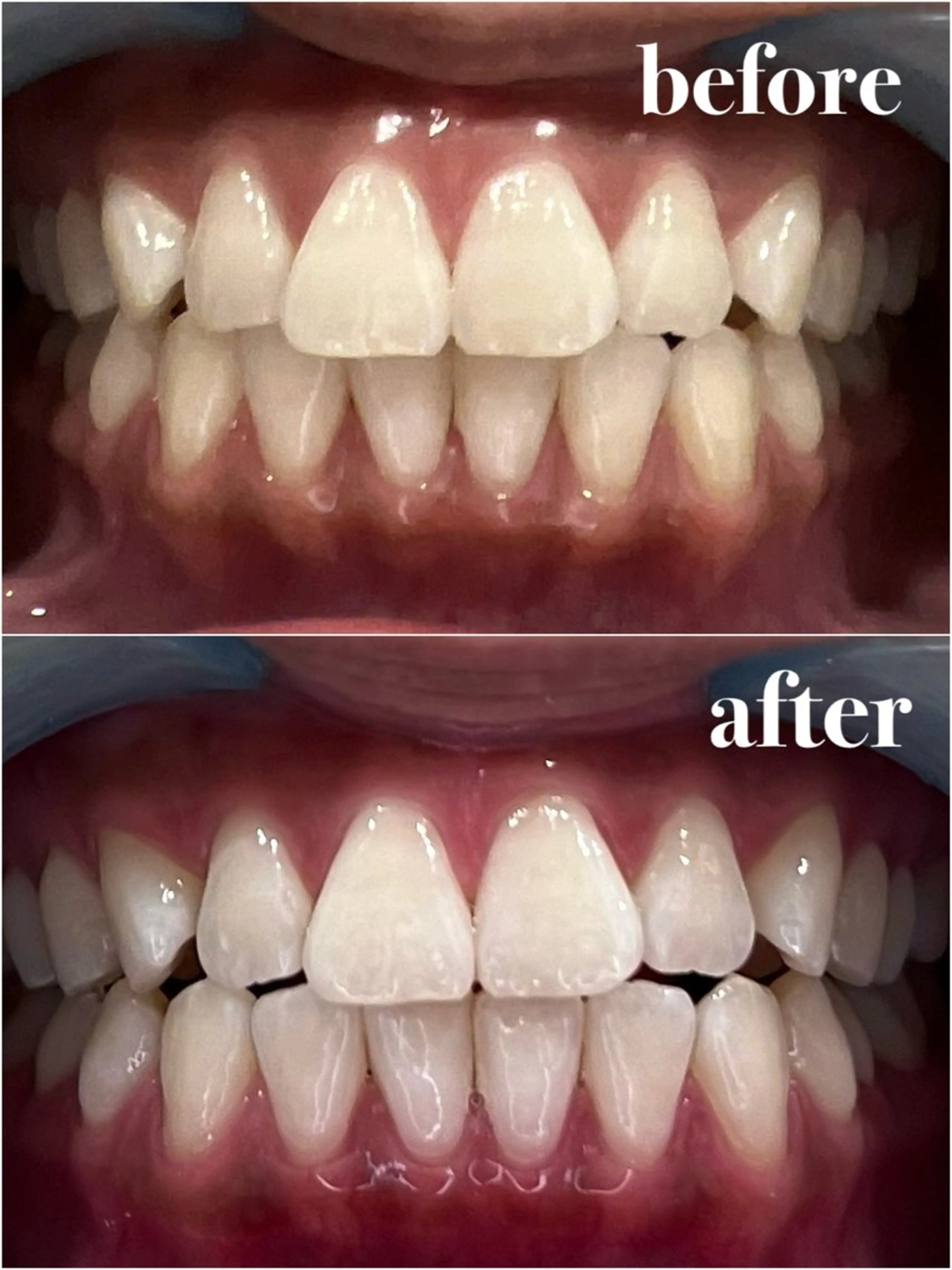 その他 𝐑𝐞𝐯𝐢𝐨 ___堺市西区のマツエク・マツパデザイン