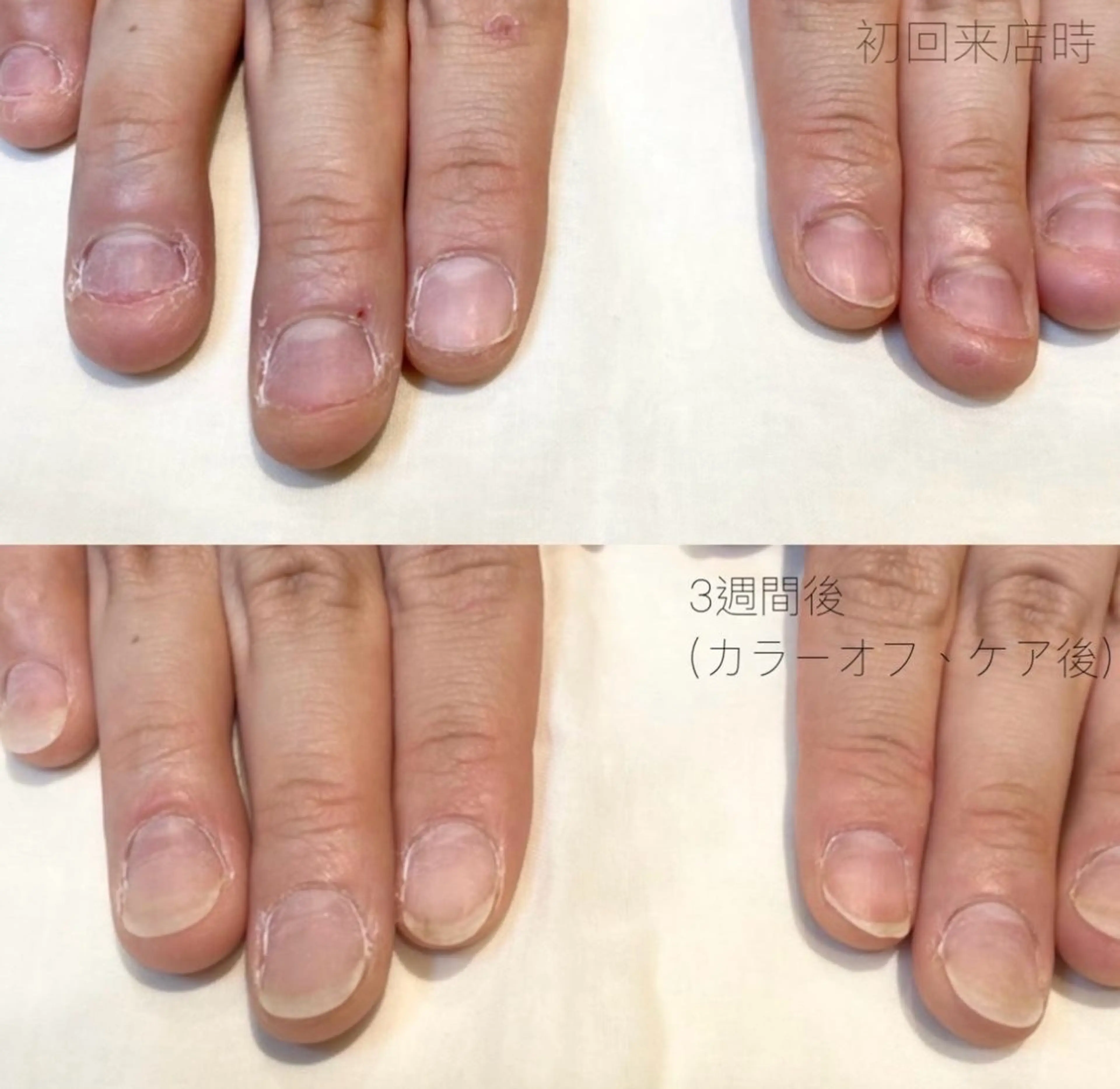 相澤 瑠佳🛋️のネイルデザイン