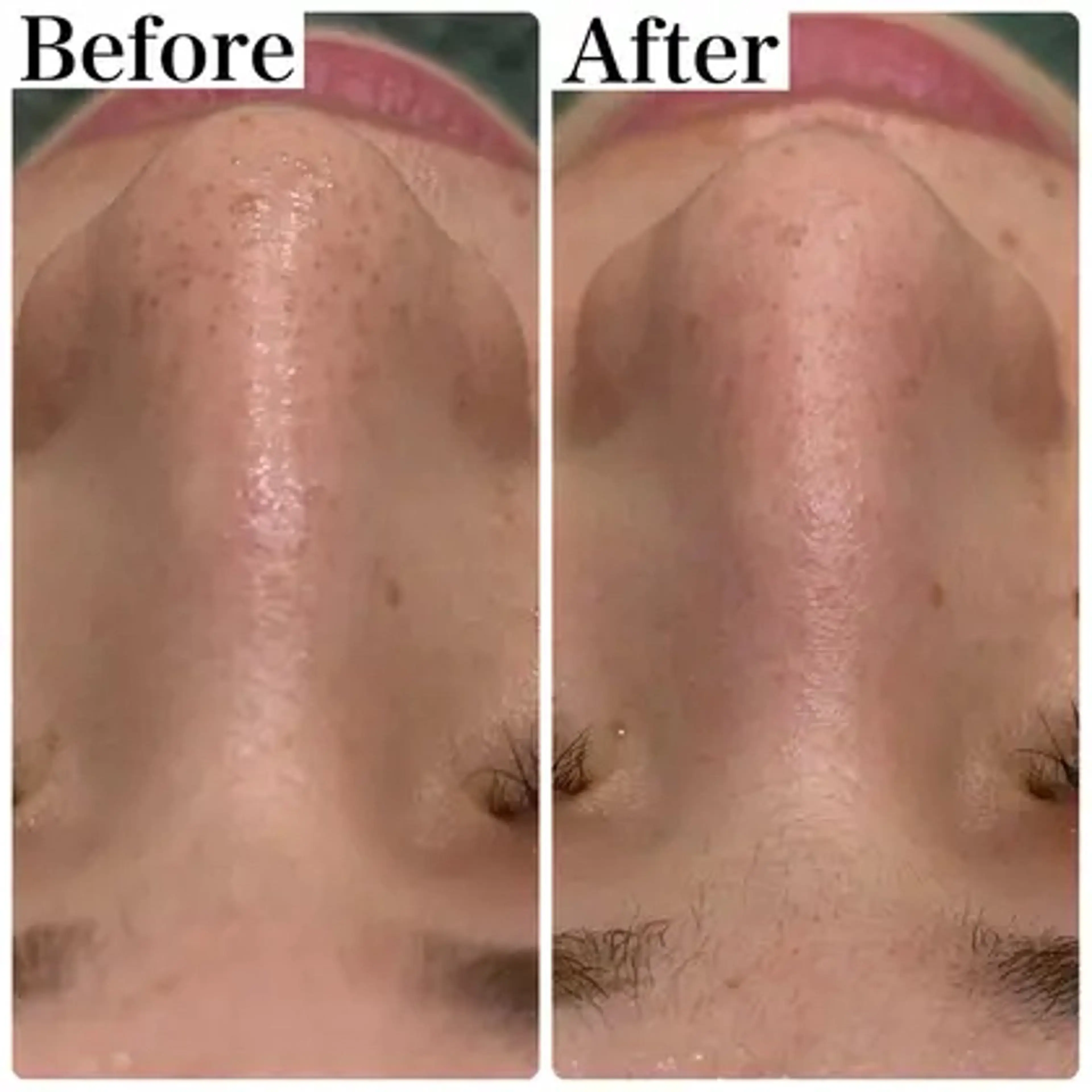 エステ 美肌脱毛サロン muroのエステ・リラクイメージ