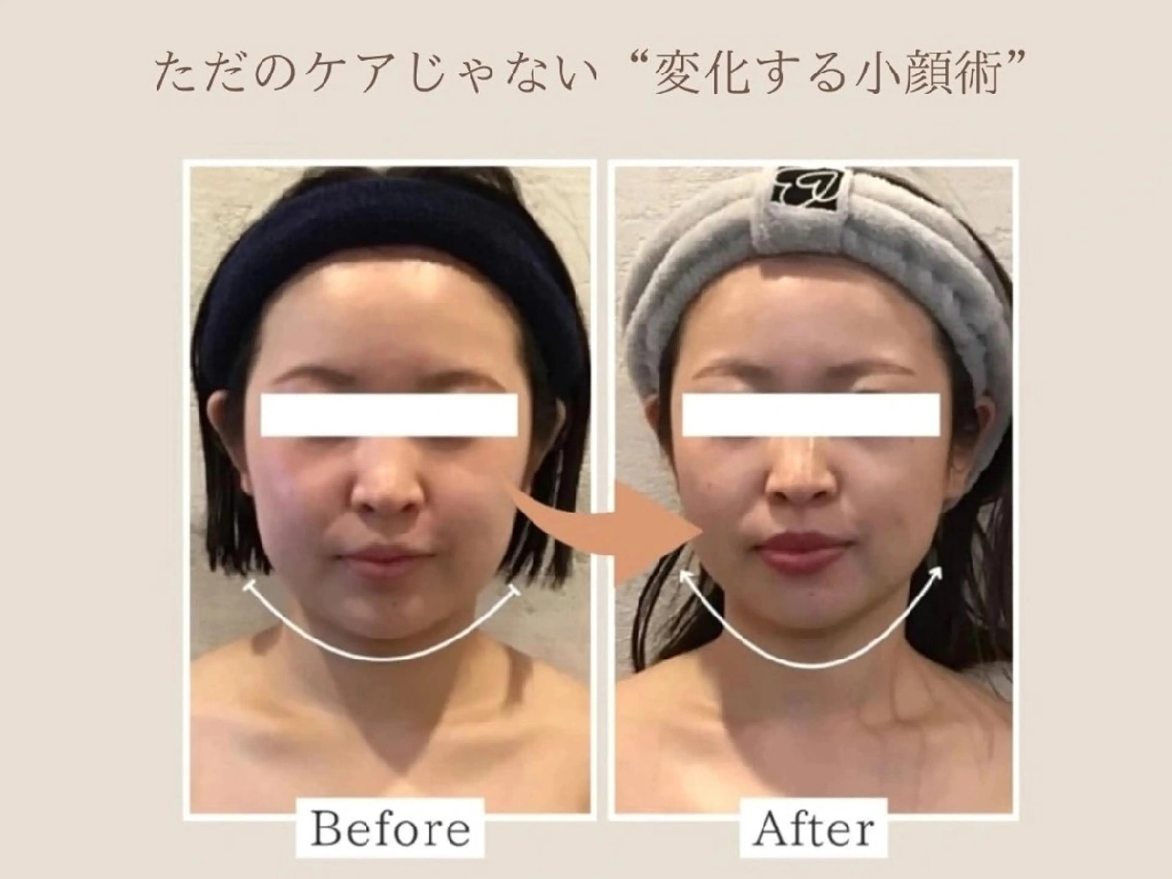 小顔FaceLabo 姫路店のエステ・リラクイメージ