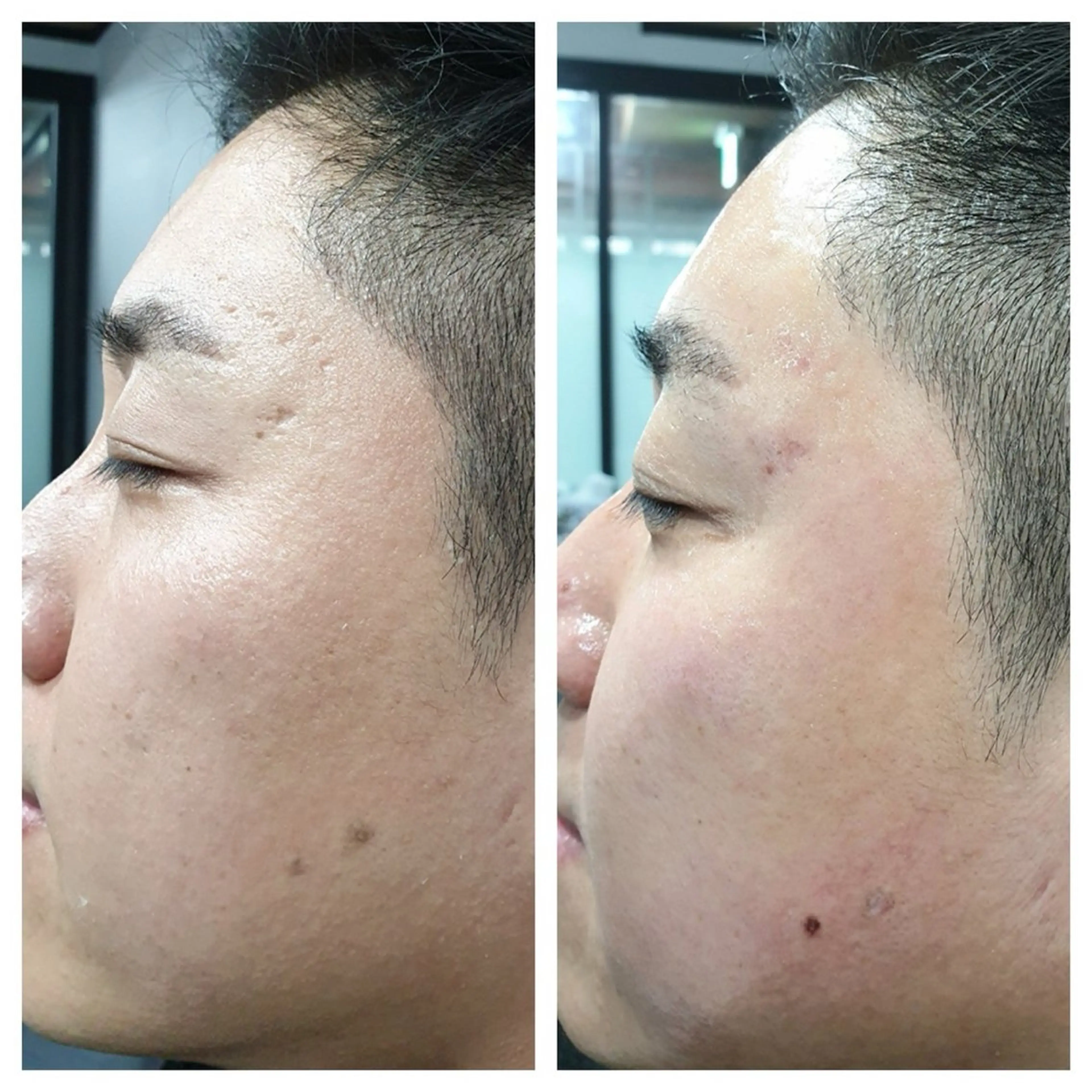 エステ リラク natsumi - オーナー -のネイルデザイン