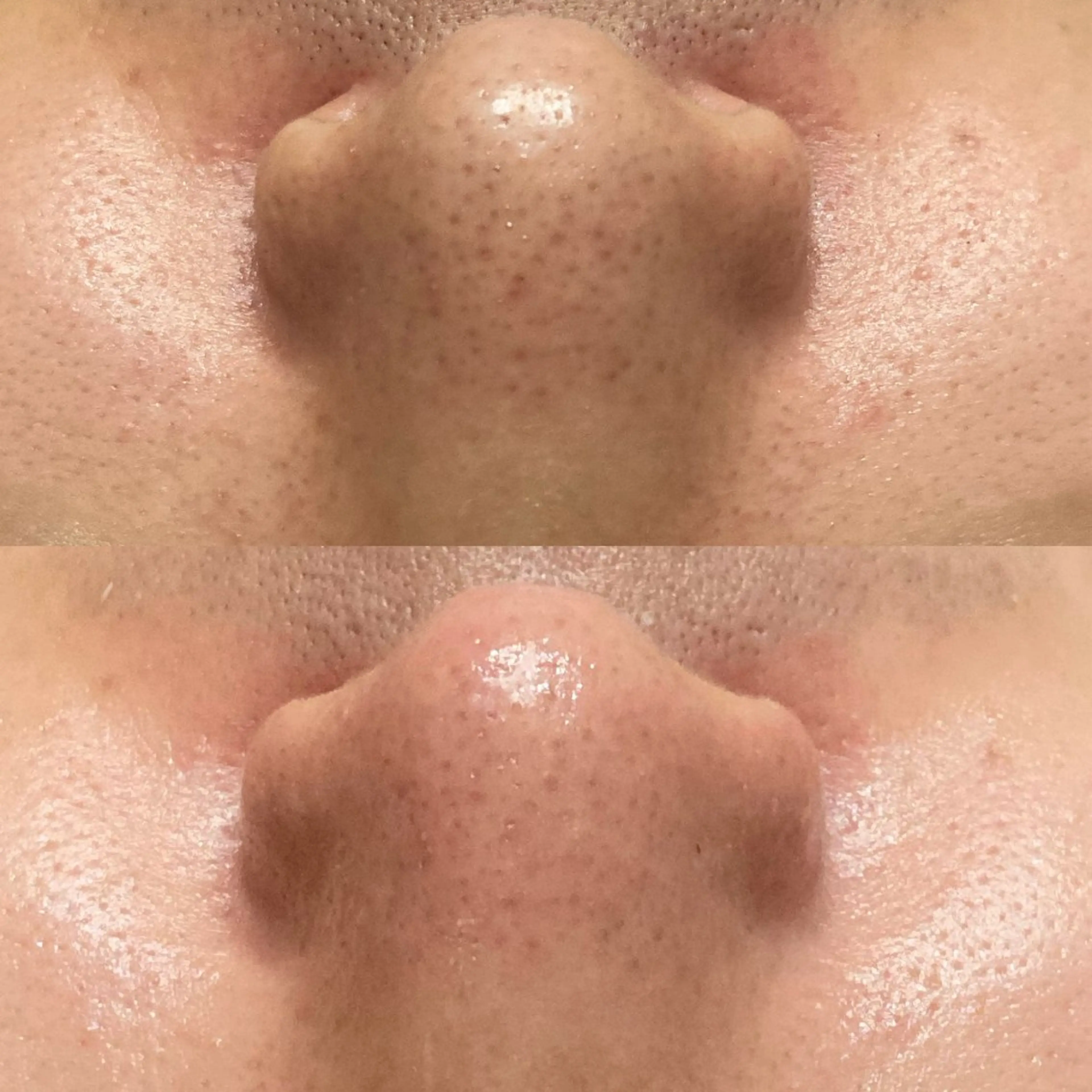 磐田｜LAYLA 一番丁寧な脱毛店のエステ・リラクイメージ