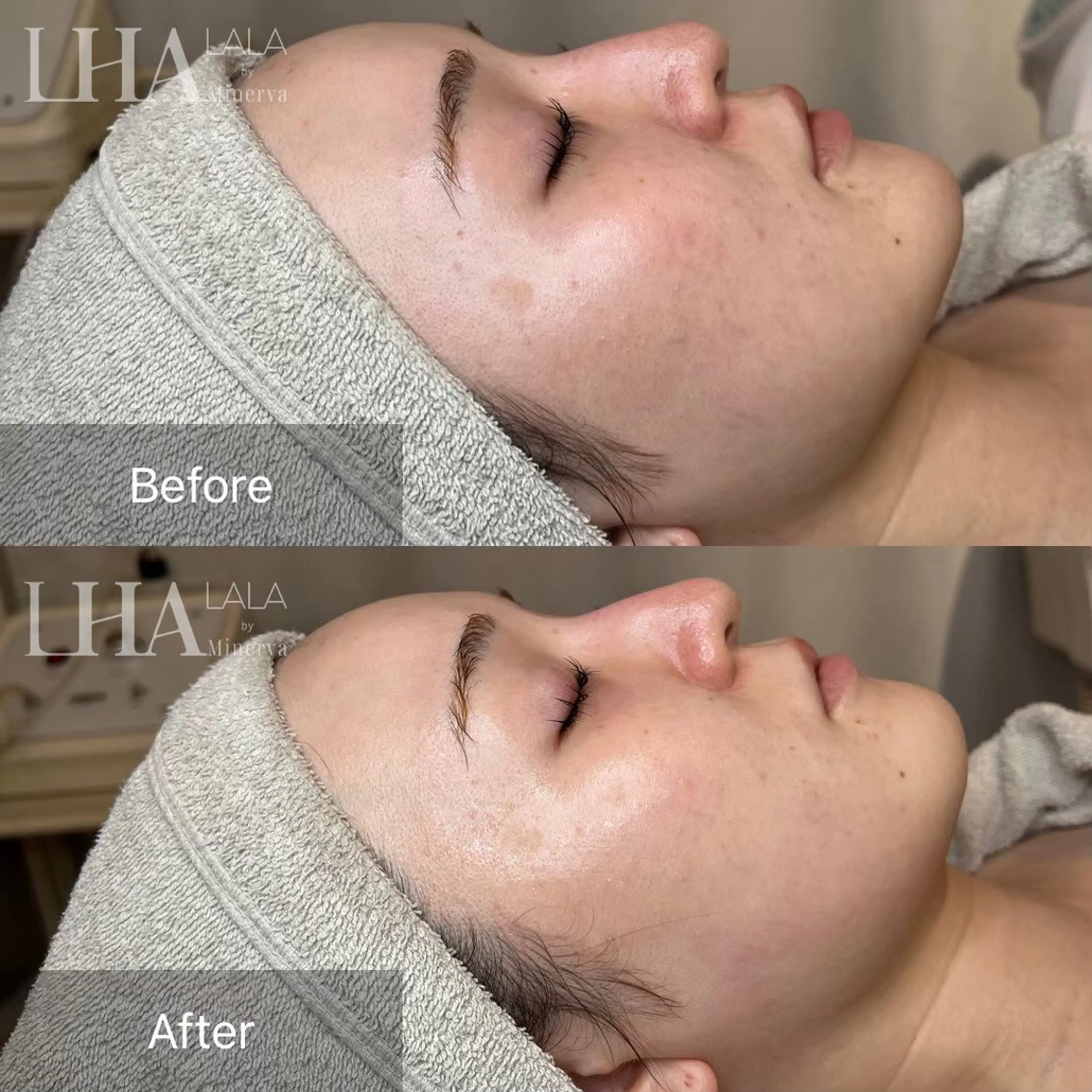 GAKU 【IGO】のエステ・リラクイメージ