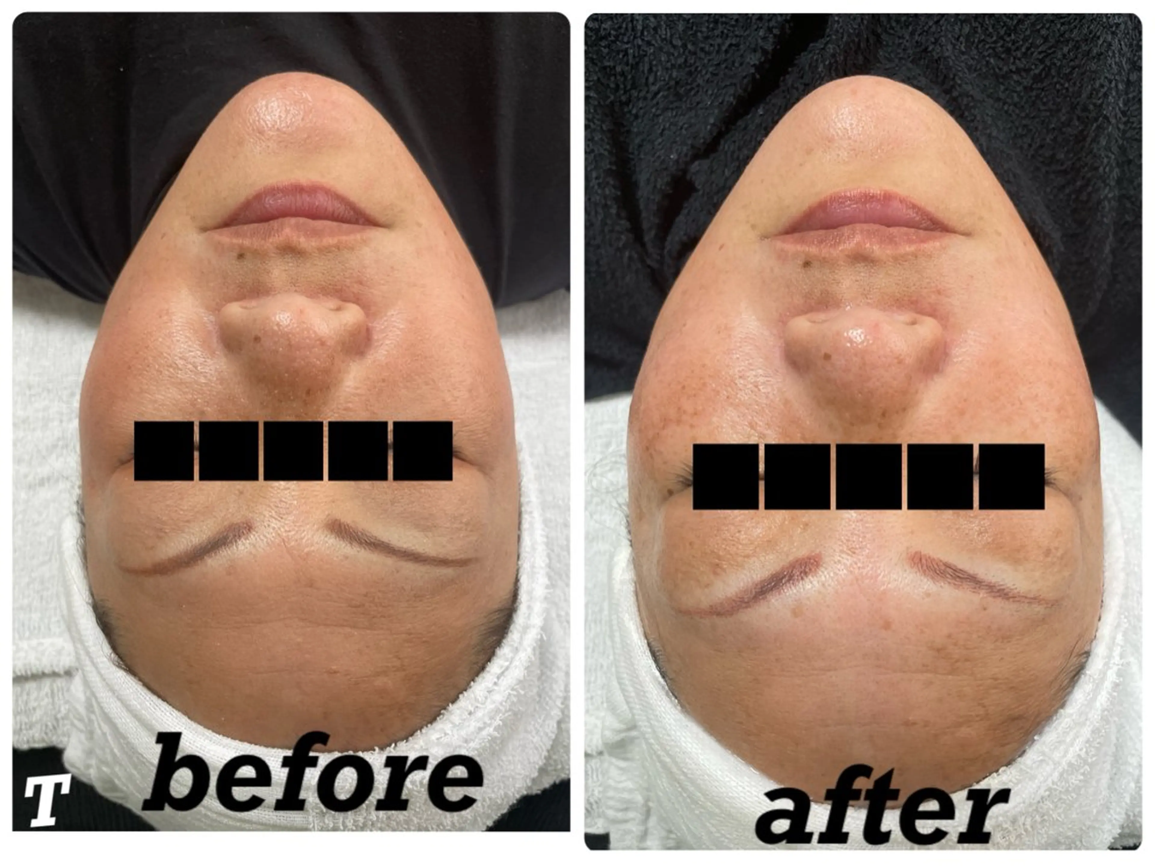 ÉMIA ✴︎のエステ・リラクイメージ