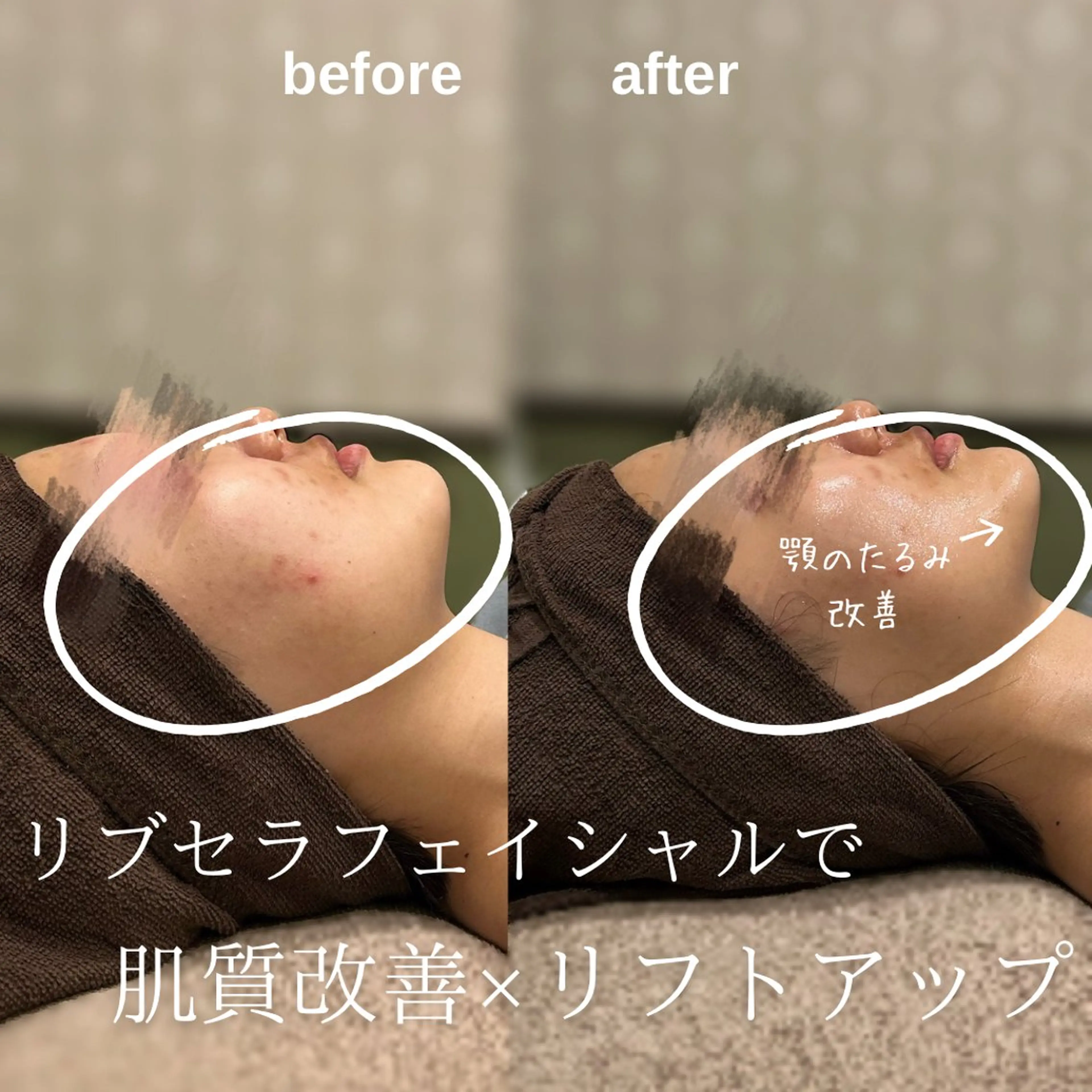 エステ 💎美容革命ラボ💎 大名店のエステ・リラクイメージ