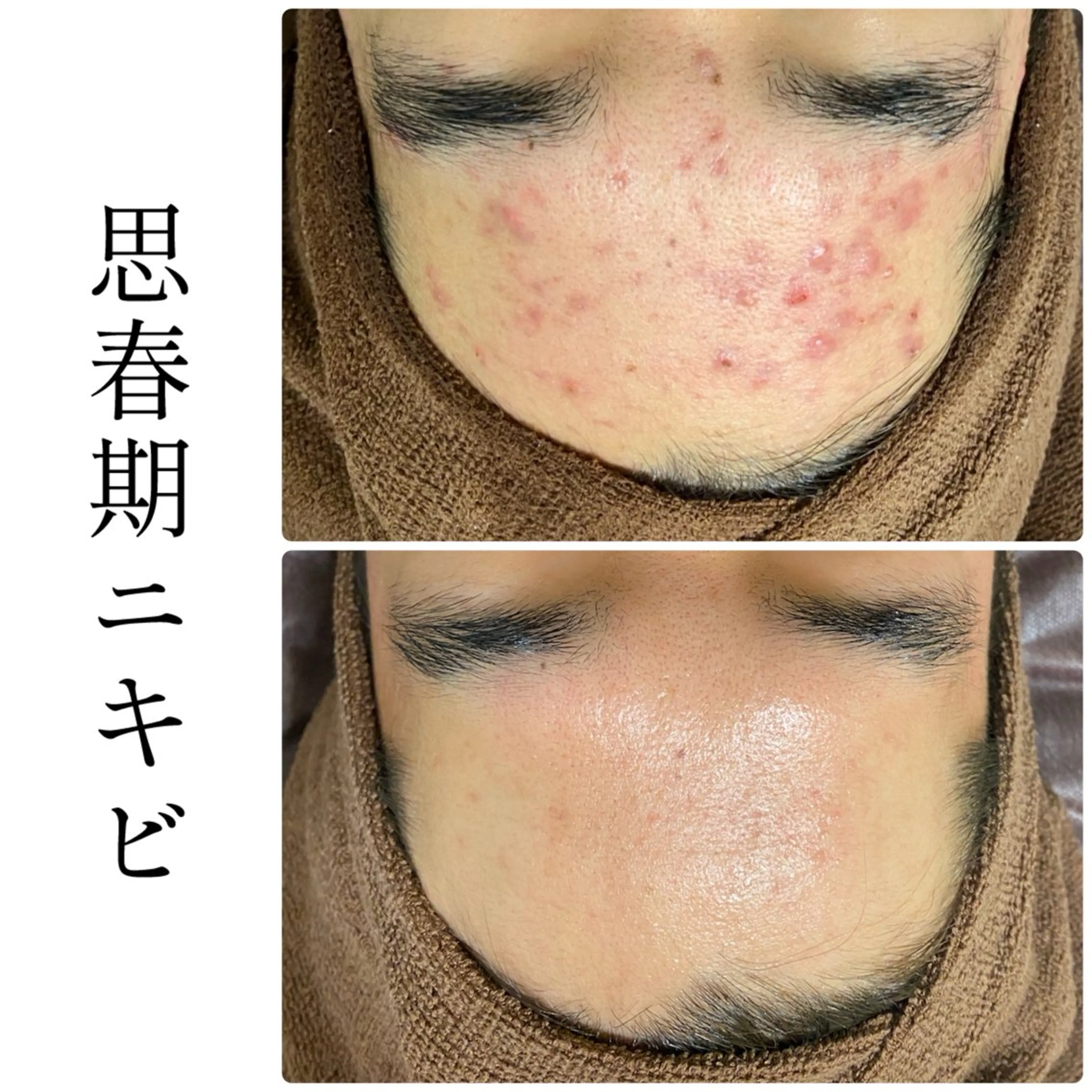 エステ ハーブピーリング専門 BIOEL横浜のエステ・リラクイメージ