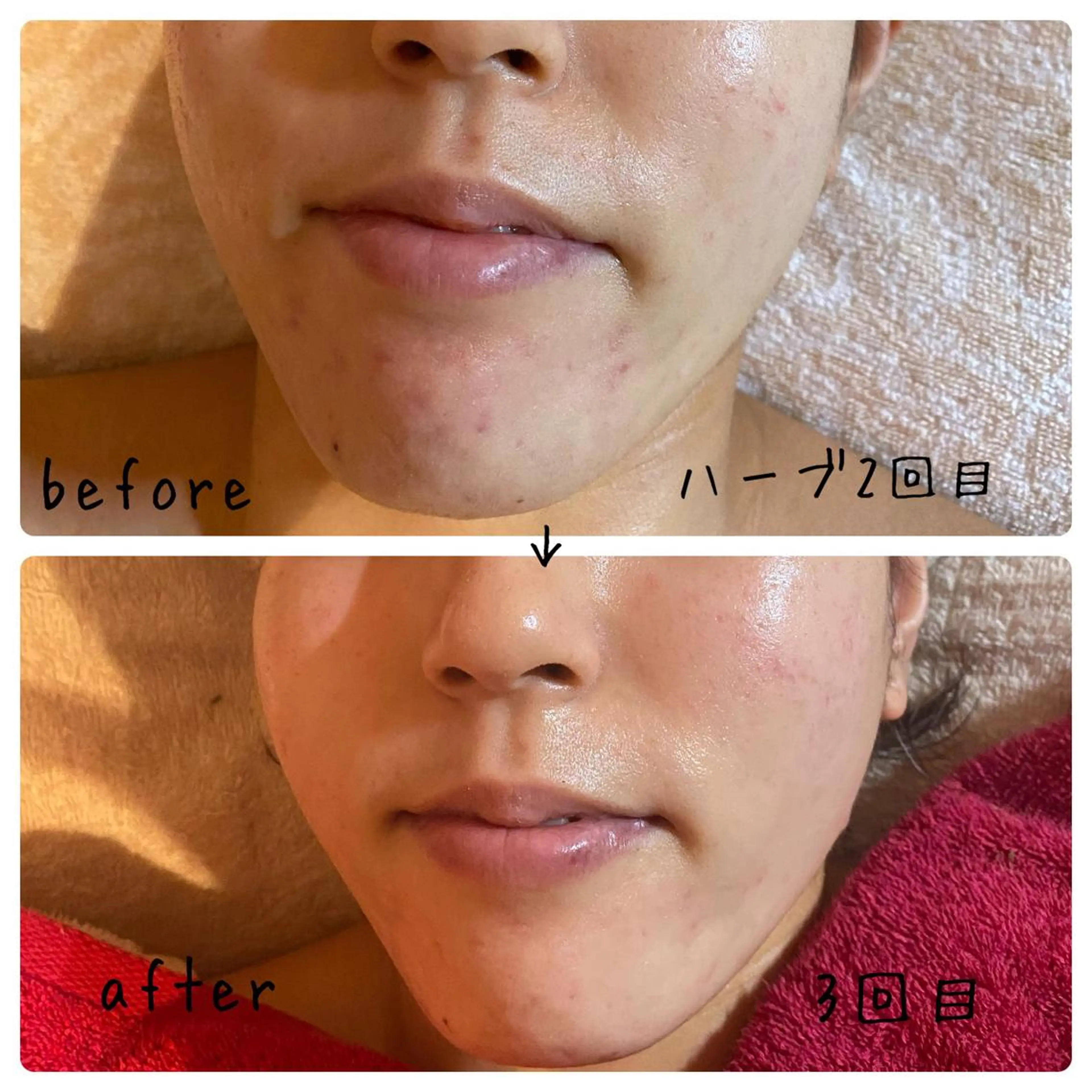 フェアリーローズ所属・fairyrose organicエステのエステ・リラクイメージ