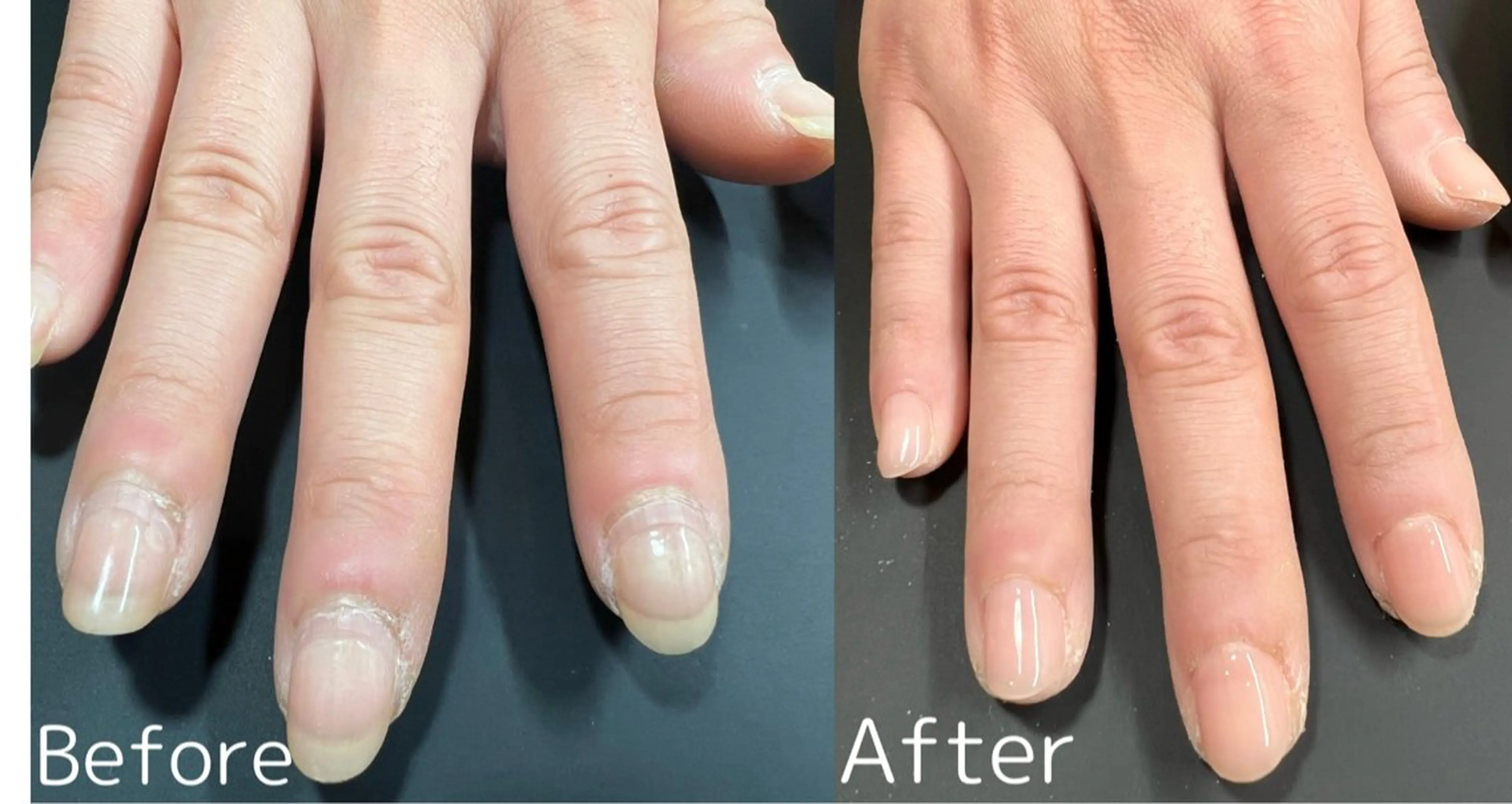 ネイル パラジェル取扱サロン rosa nailのネイルデザイン