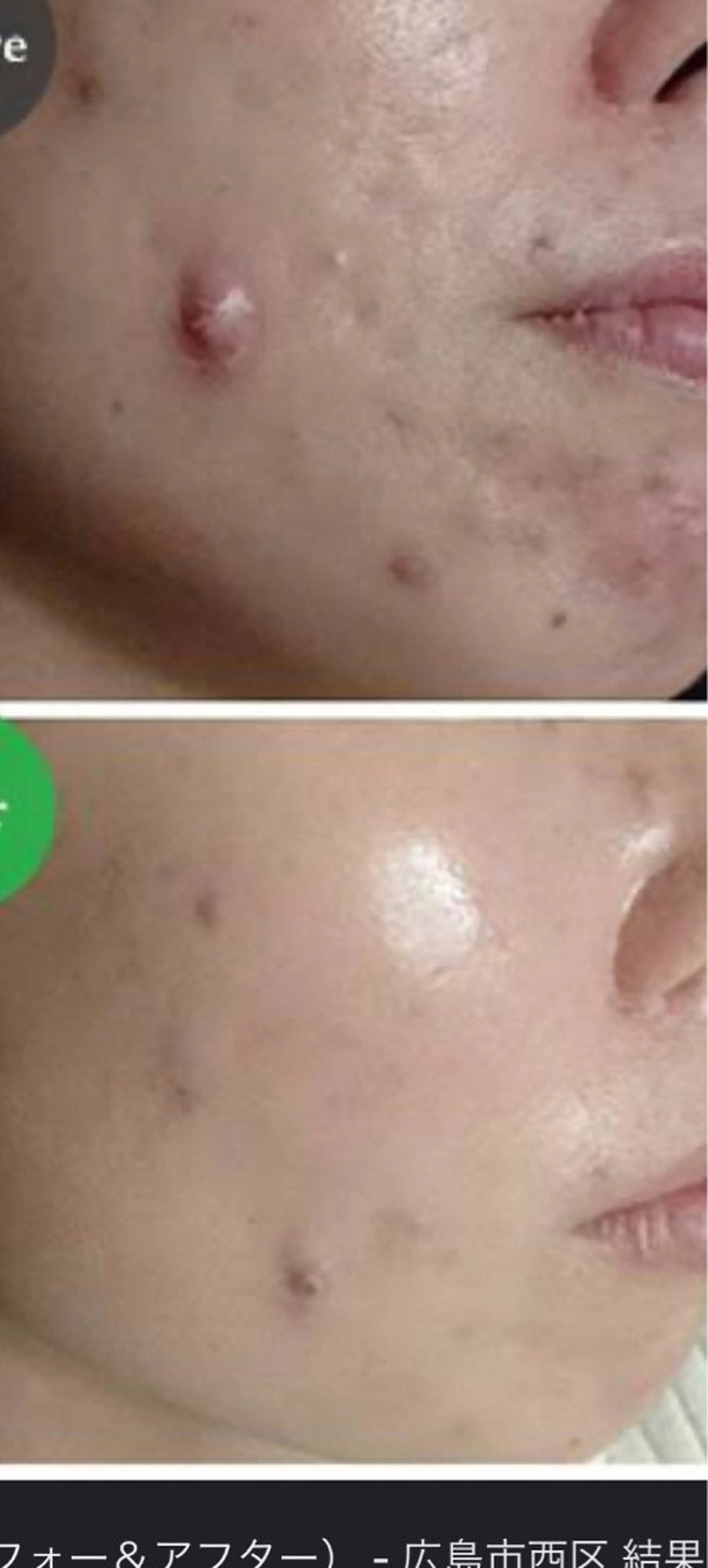 エステ ☺ハーブピール💕 ソフィアカロン💖のエステ・リラクイメージ