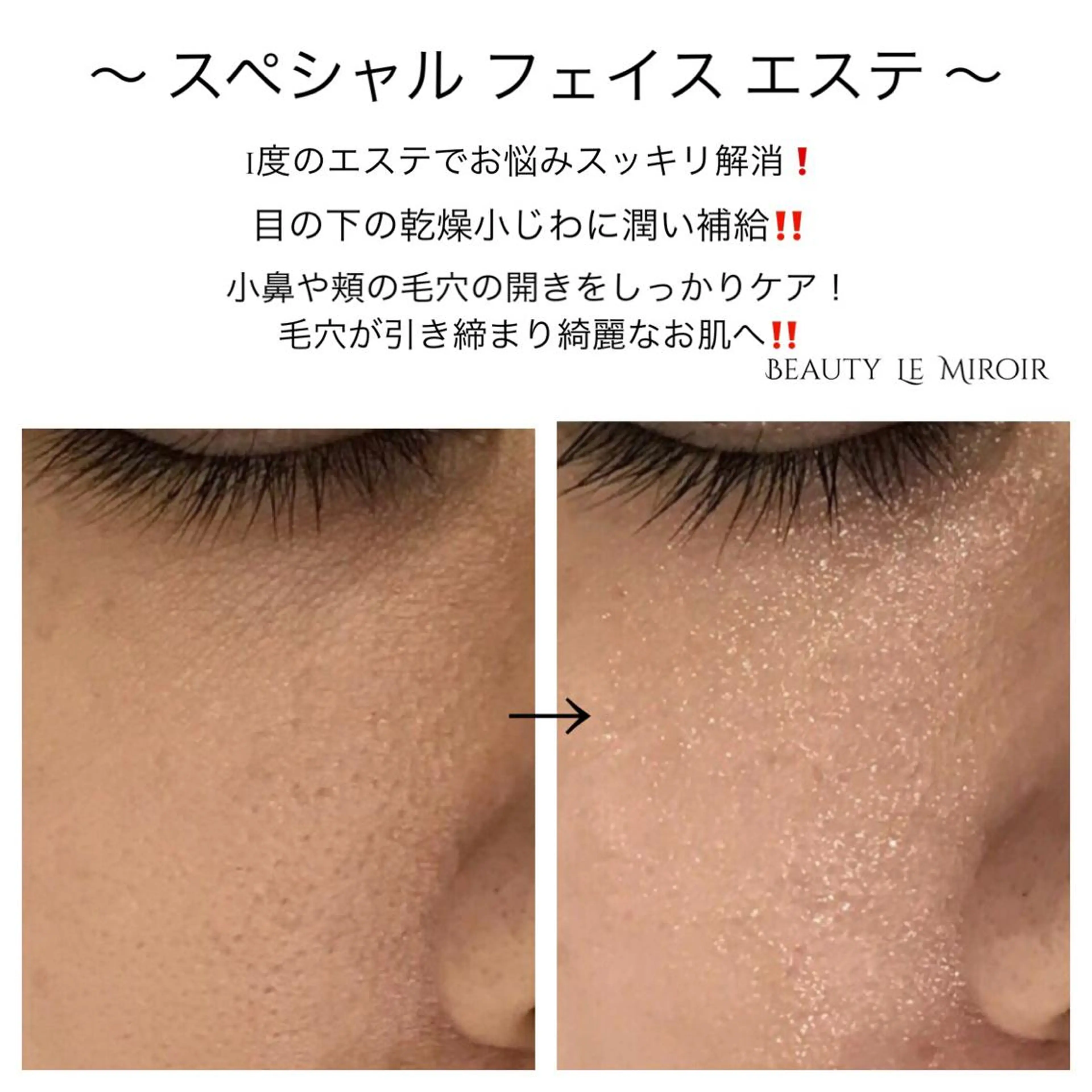 ビューティー ミロワールのエステ・リラクイメージ