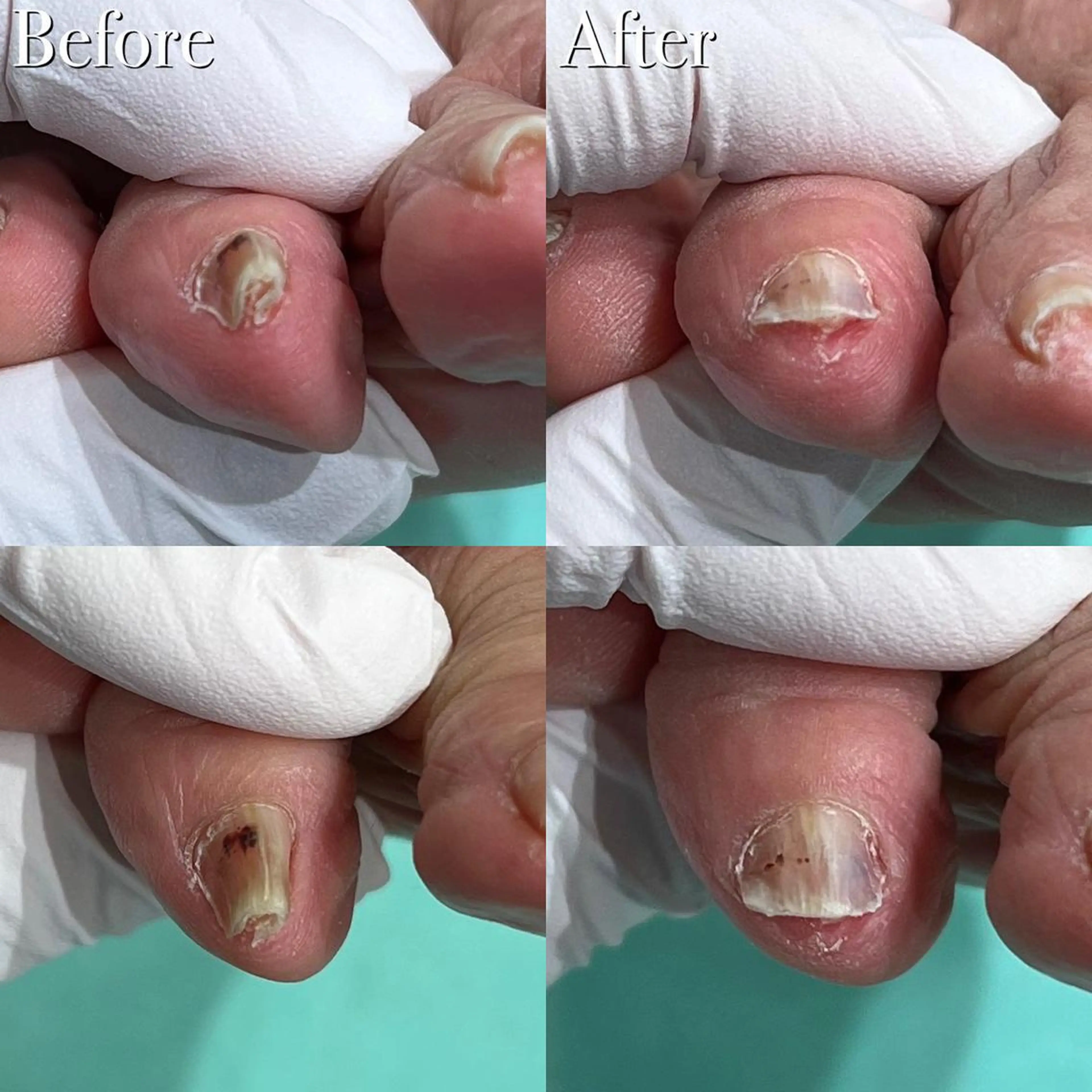 東京巻き爪アカデミー所属・東京巻き爪 アカデミーのエステ・リラクイメージ