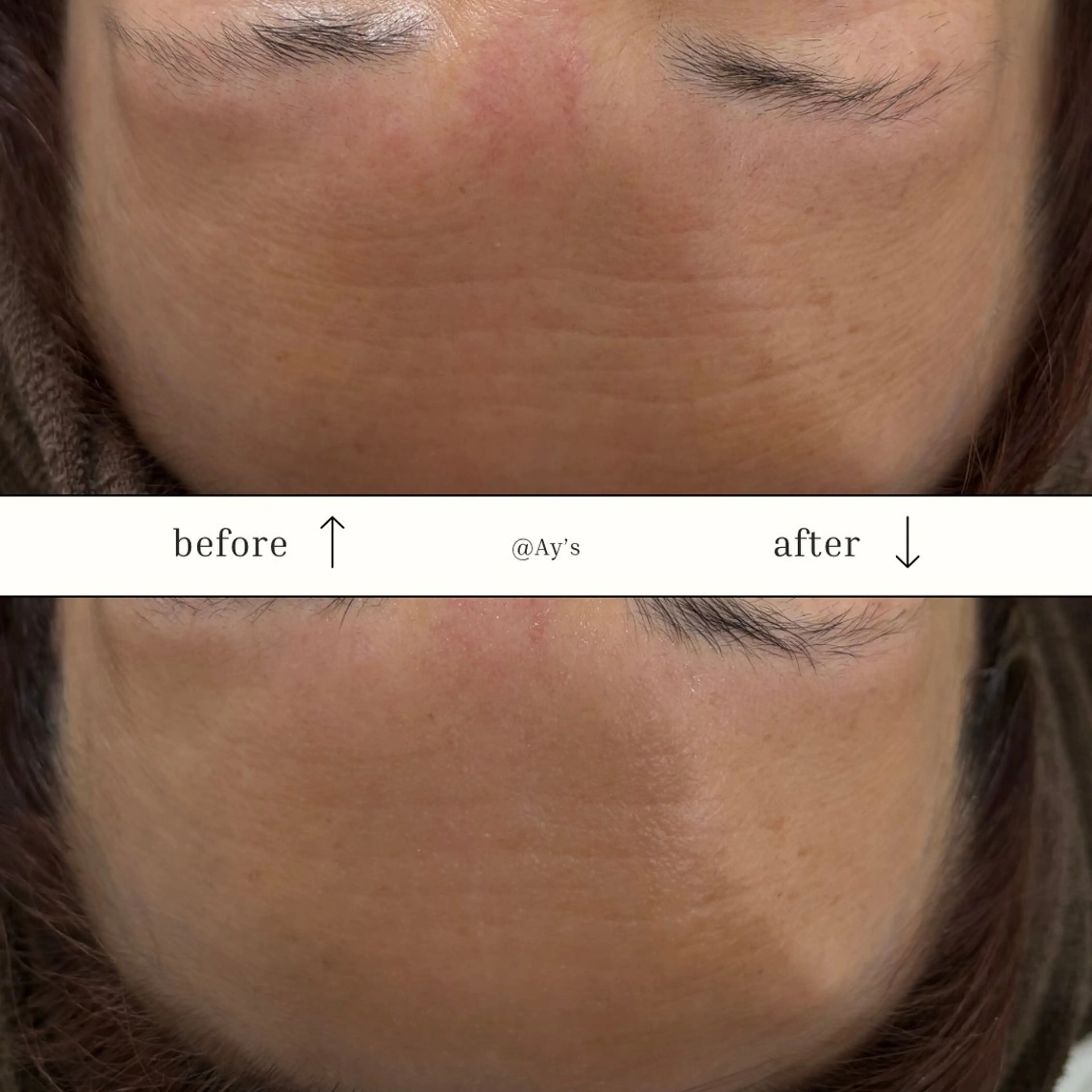 エステ 倉敷/玉島/20代 からの大人毛穴洗浄のエステ・リラクイメージ