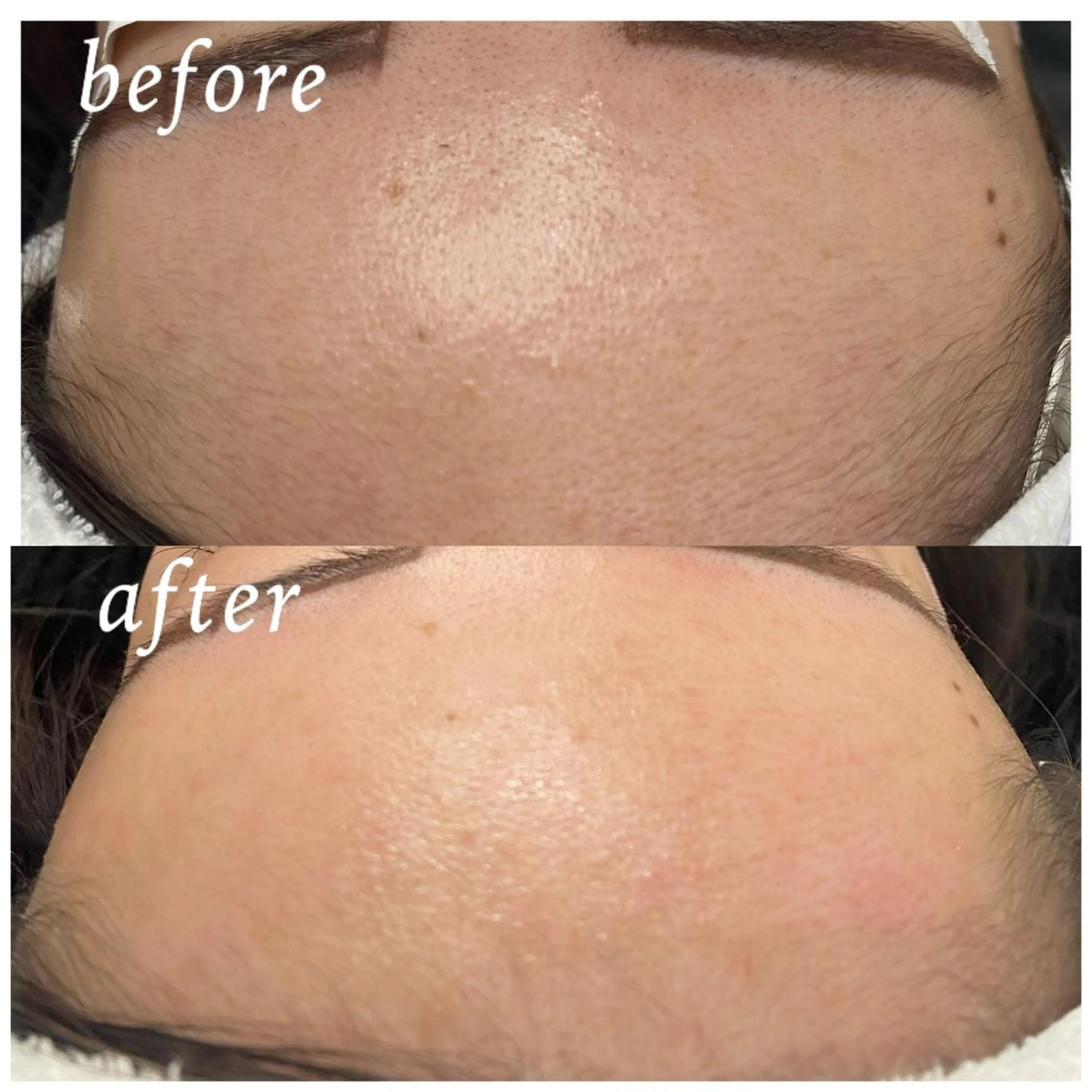 ワックス脱毛 サロン ブルージュの眉毛・アイブロウイメージ