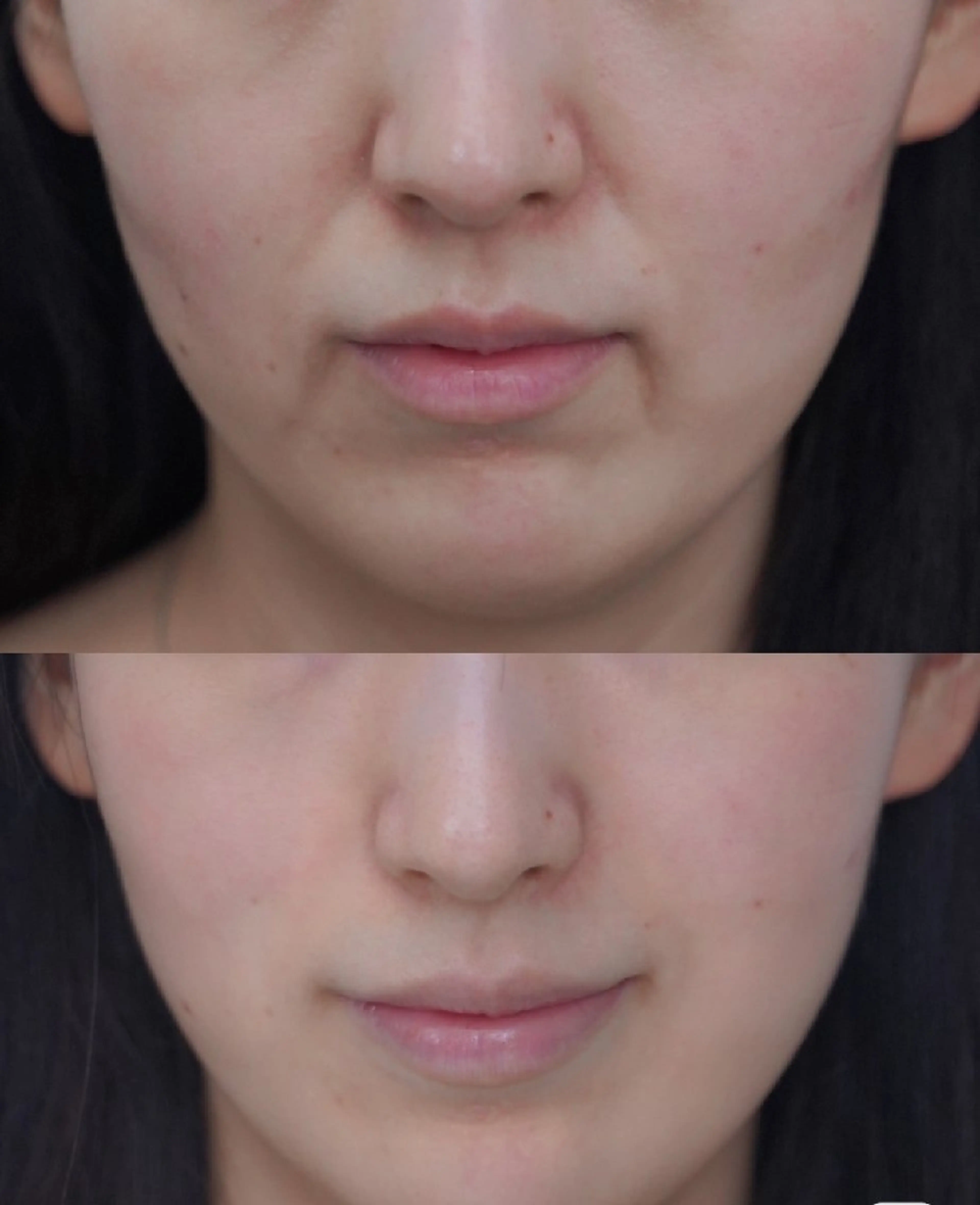 マツエク・マツパ 結婚式・ブライダル aliaハーブ水光店 エステティシャン募集のエステ・リラクイメージ