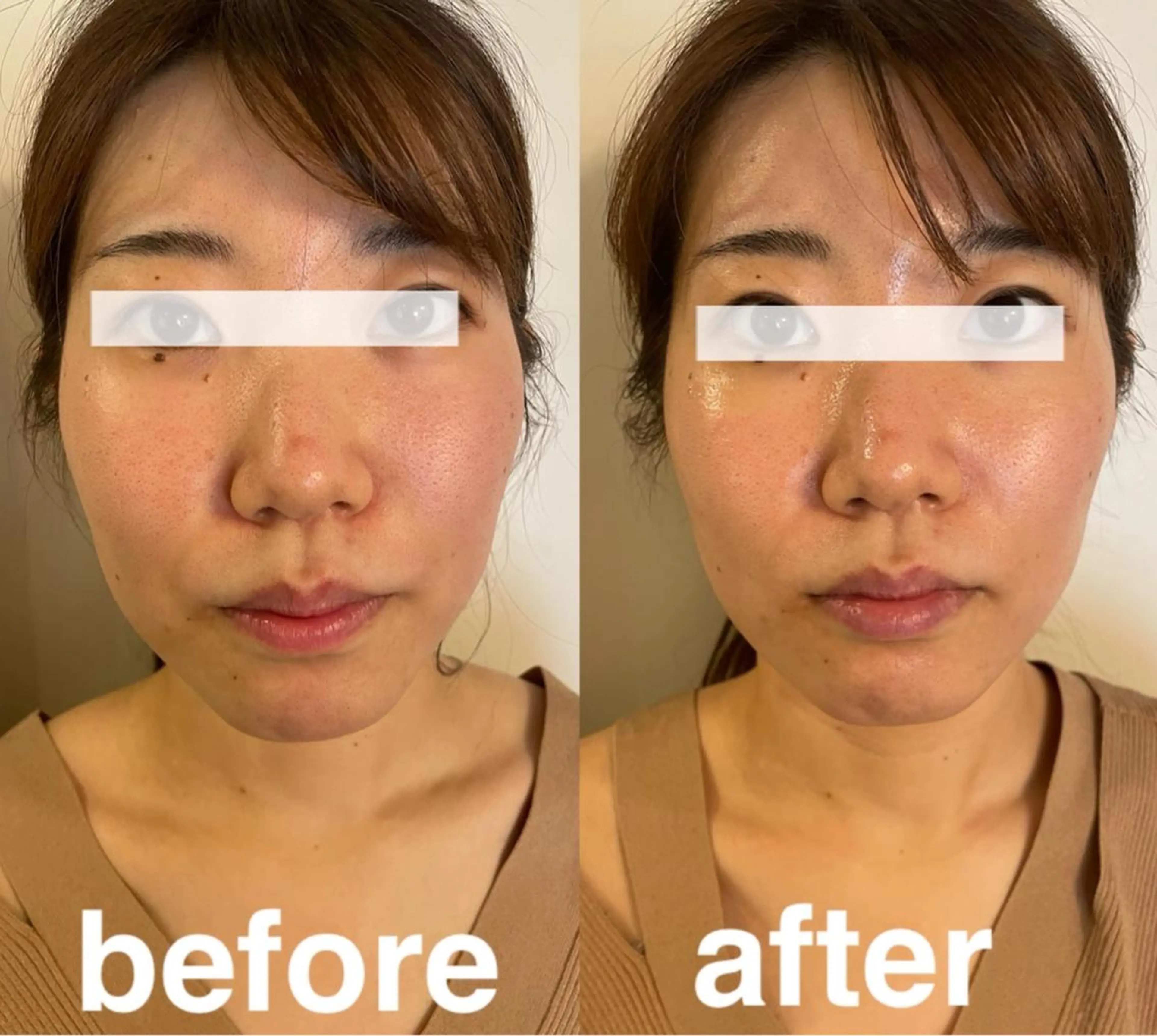 美容鍼灸サロン mahoroba院長のエステ・リラクイメージ