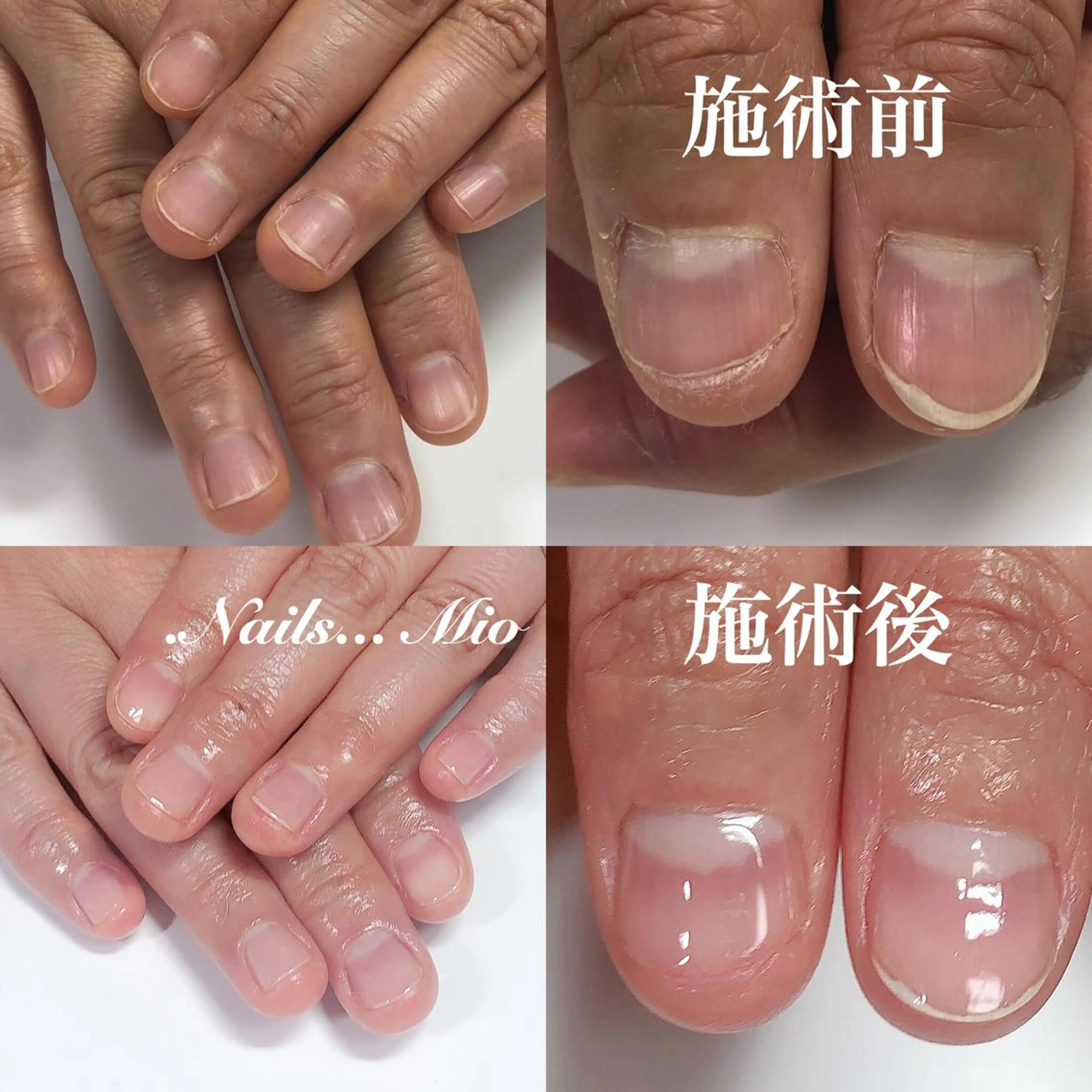 ネイル .Nails Mio 赤羽西ネイルサロンのネイルデザイン