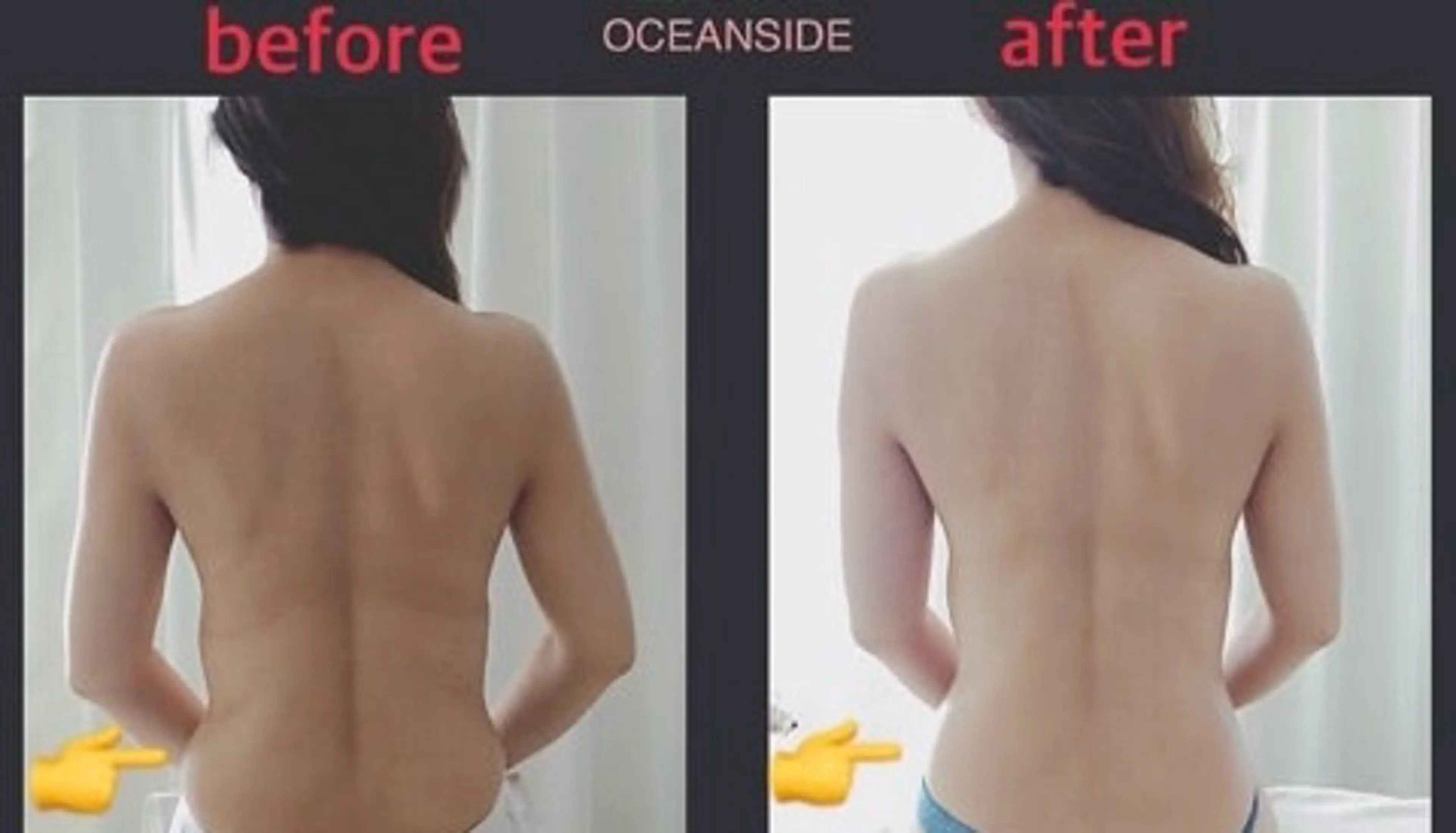 上半身の瘦身ケア✨背中スッキリ！はみ肉・厚みを取る❣の写真