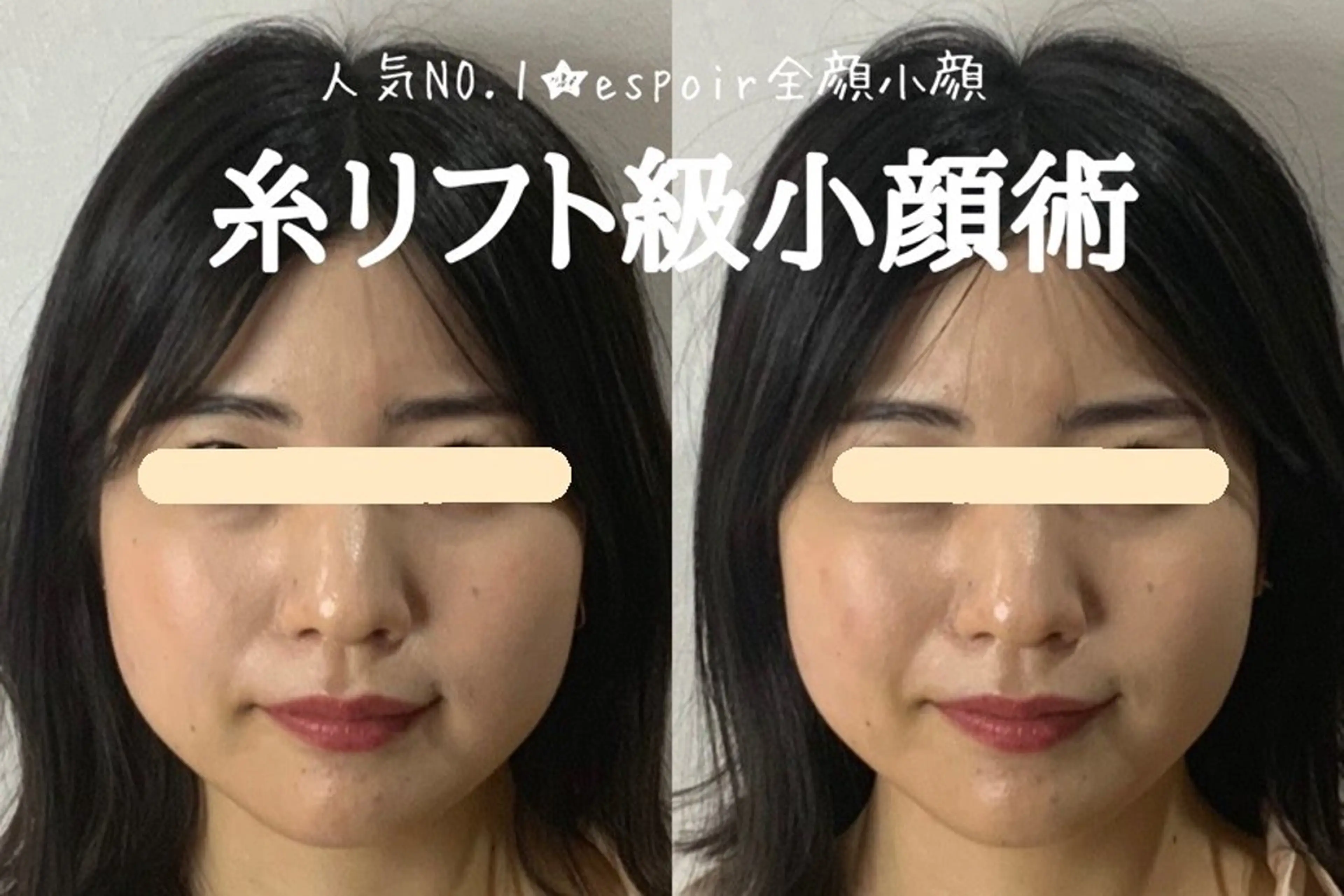 エステ リラク 最速小顔・肌質管理 espoirマキのエステ・リラクイメージ