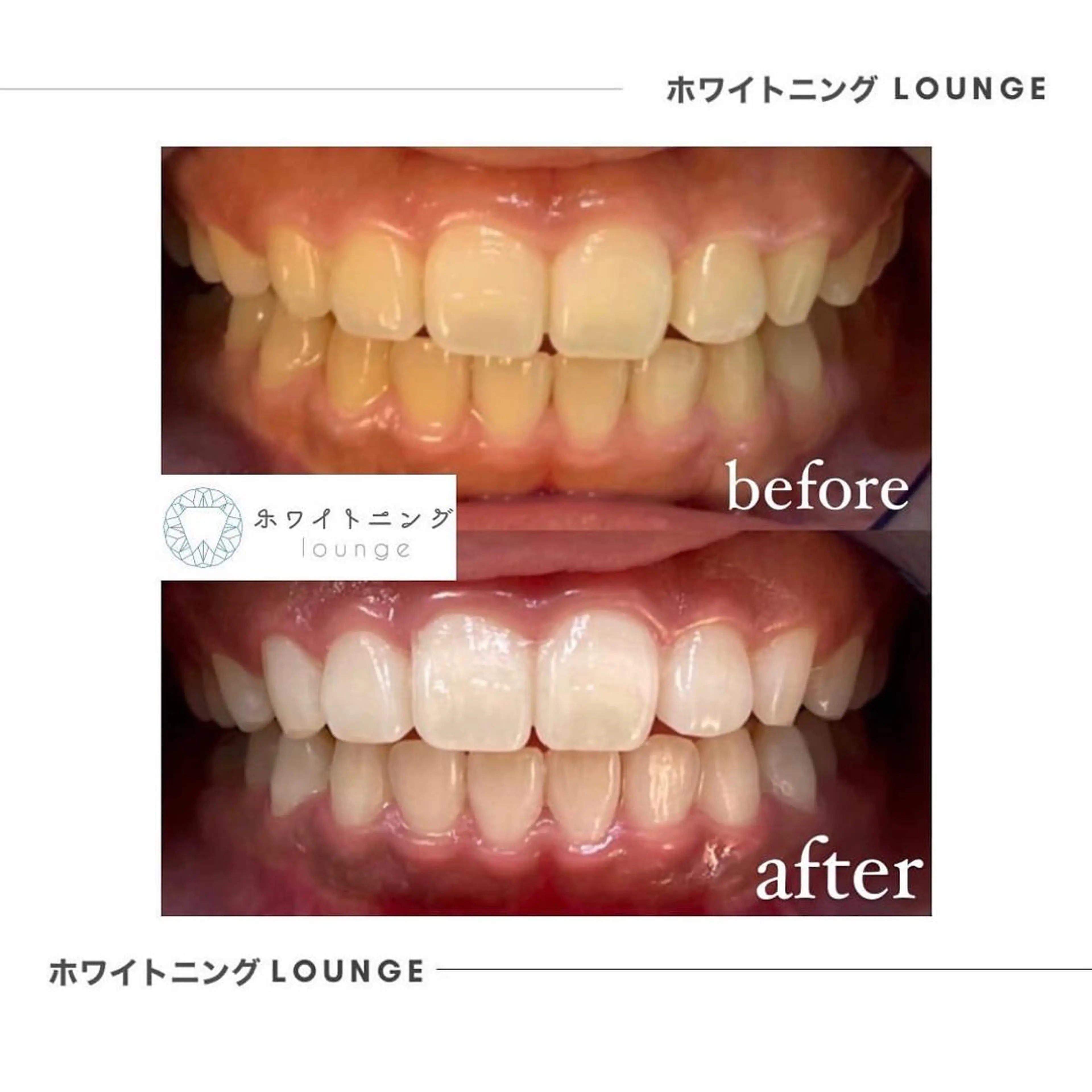 ホワイトニング Lounge横須賀のエステ・リラクイメージ