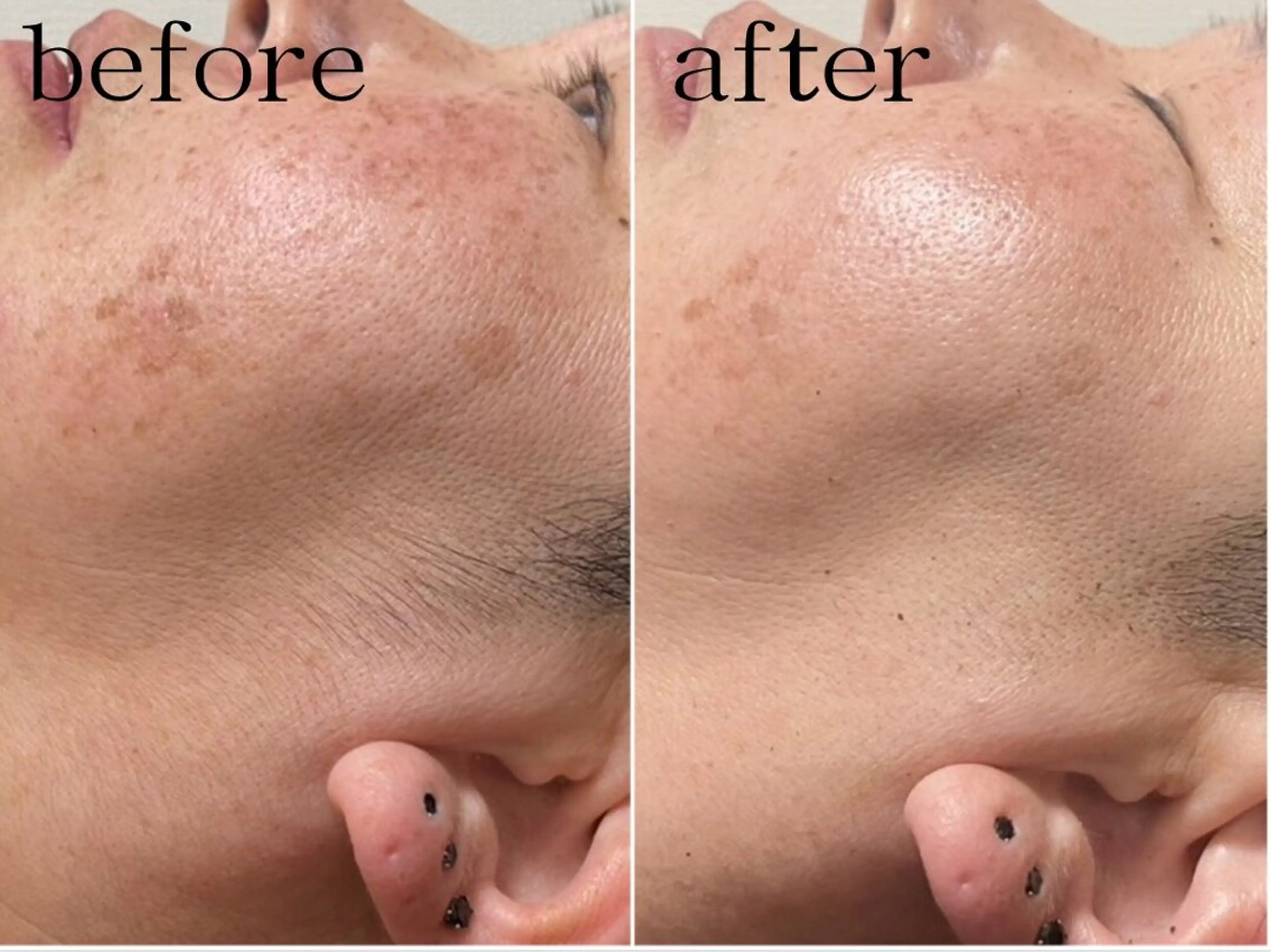 ビューティーサロン　ア・クイーユ所属・ビューティーサロン ア・クイーユのエステ・リラクイメージ