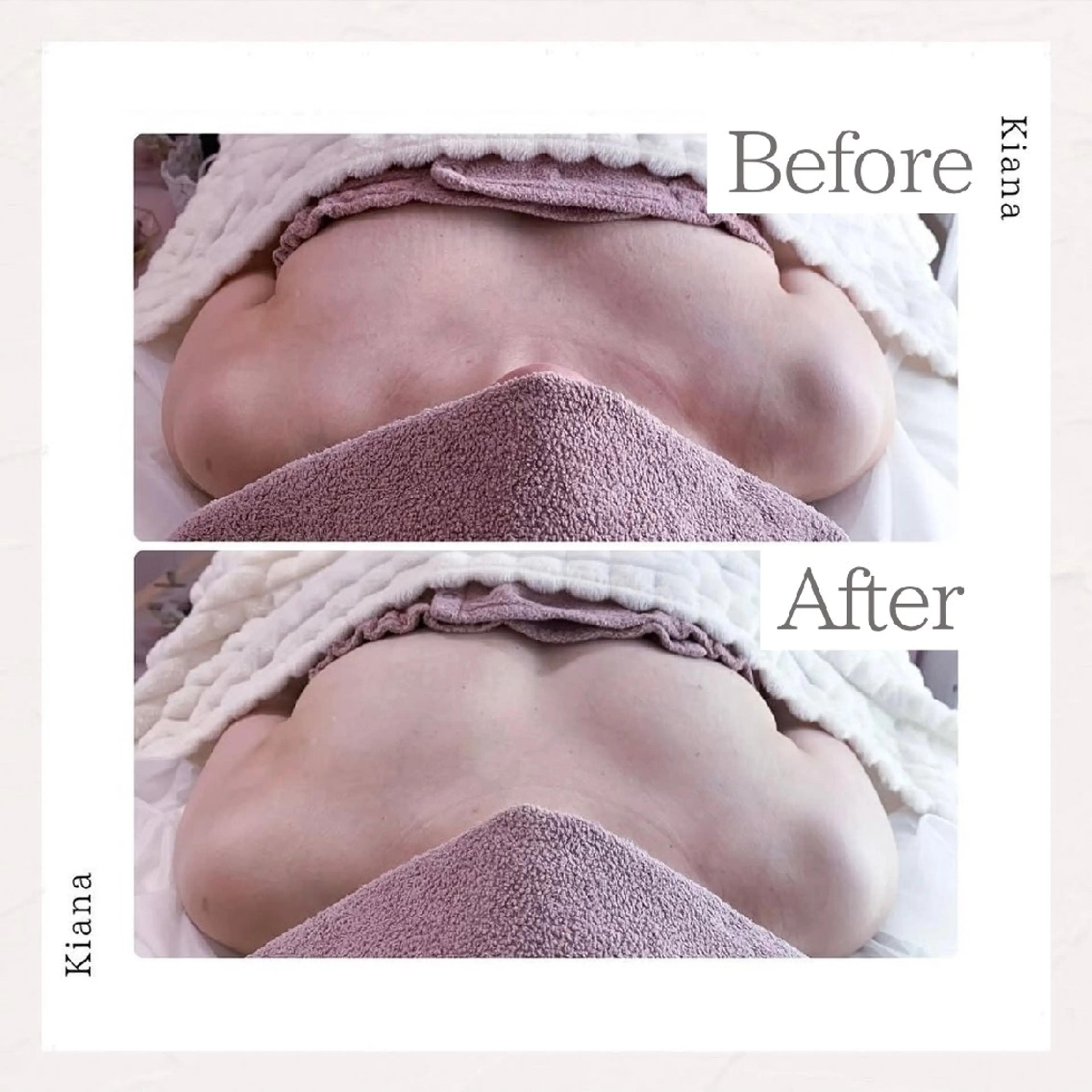 エステ リラク 【バスト専門店 】 Kiana のエステ・リラクイメージ