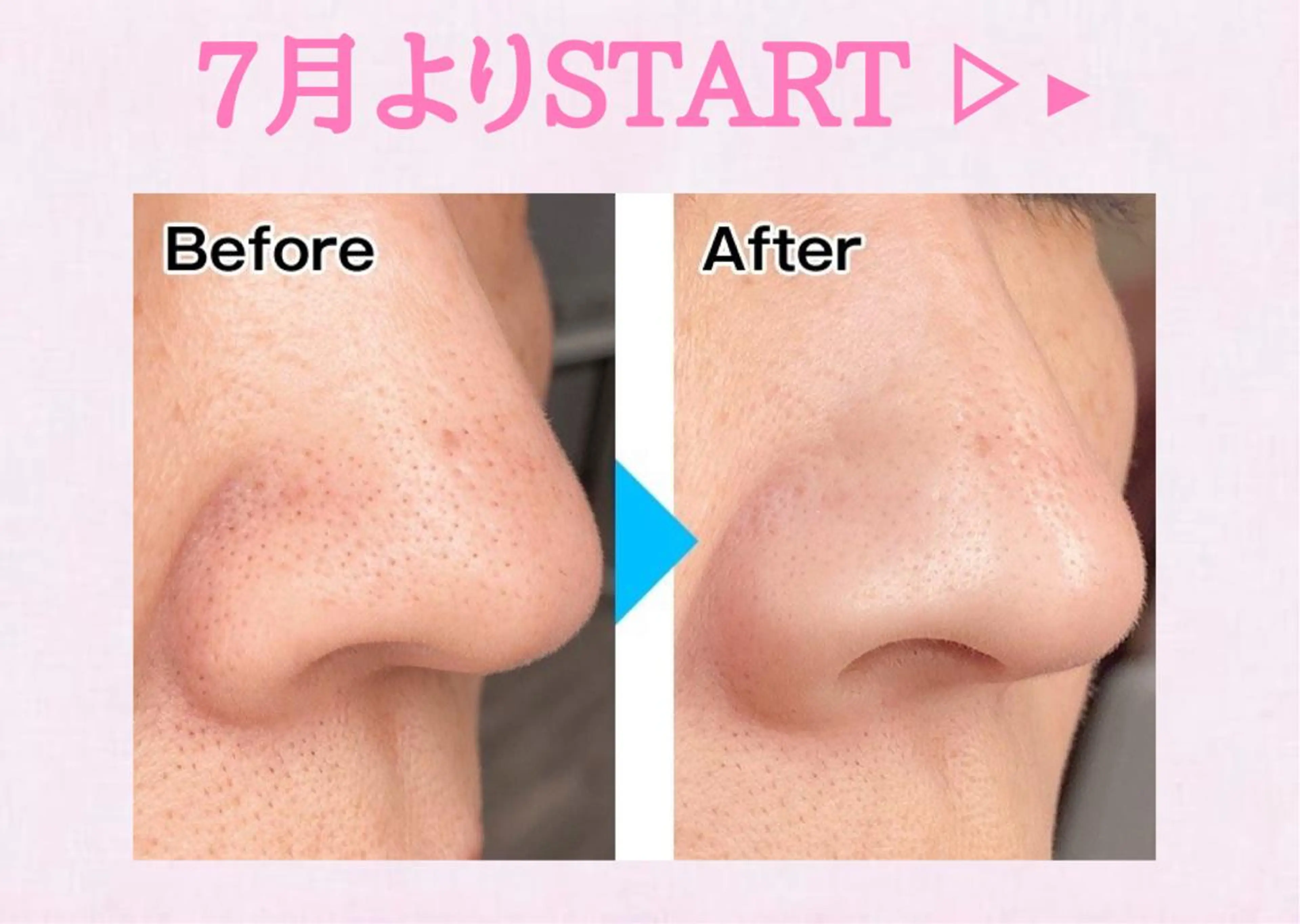 You&i(ユーアイ)所属・Nomura Suuのエステ・リラクイメージ