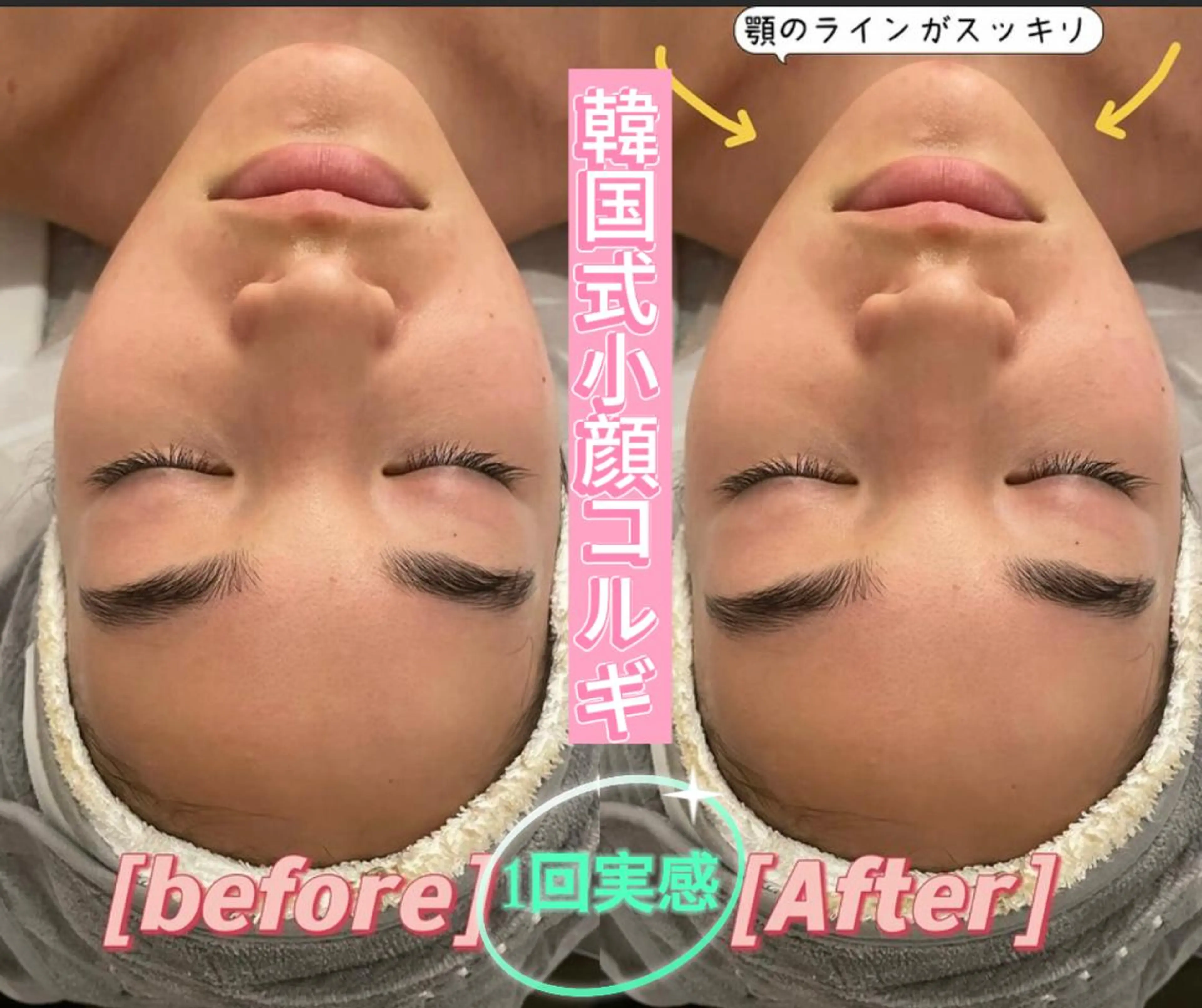 平日限定 【スピード小顔】小顔コルギ+肩首デコルテリンパケア 60分9800→¥6800の写真