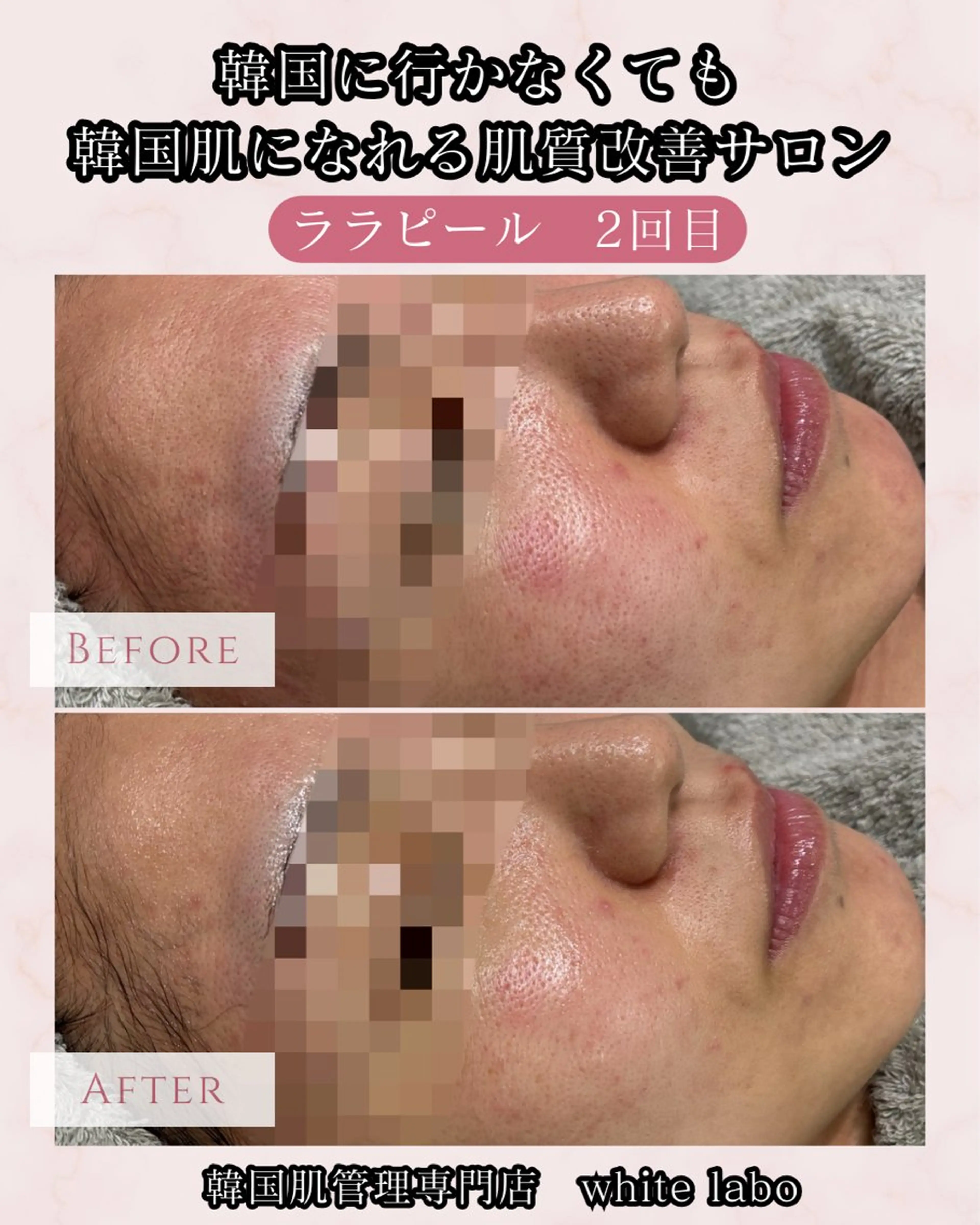 【SNSで超話題】憧れの韓国肌に💎水光肌艶ララピールの写真