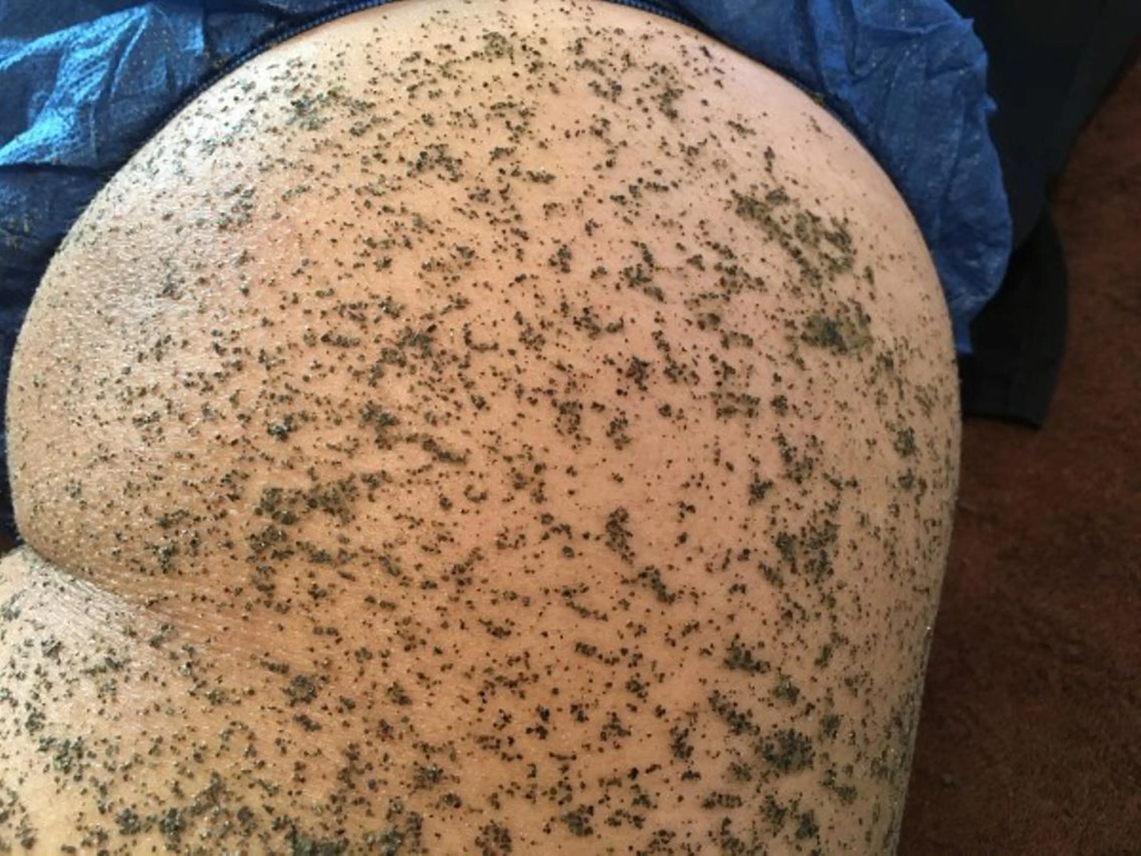 お尻のバーブピーリング【モコモコ泡パック付き】の写真