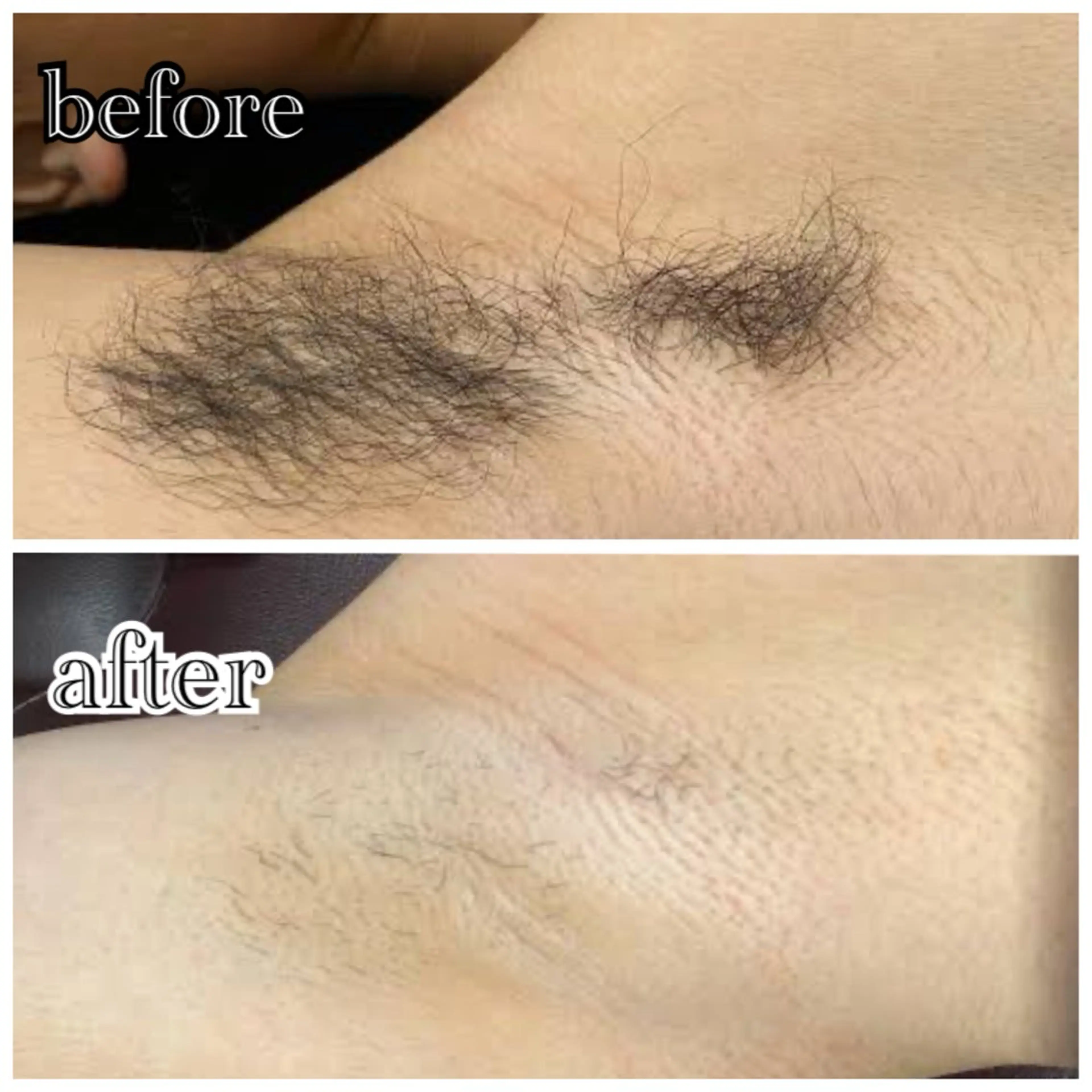 メンズ メンズ脱毛サロン SHINKAのエステ・リラクイメージ