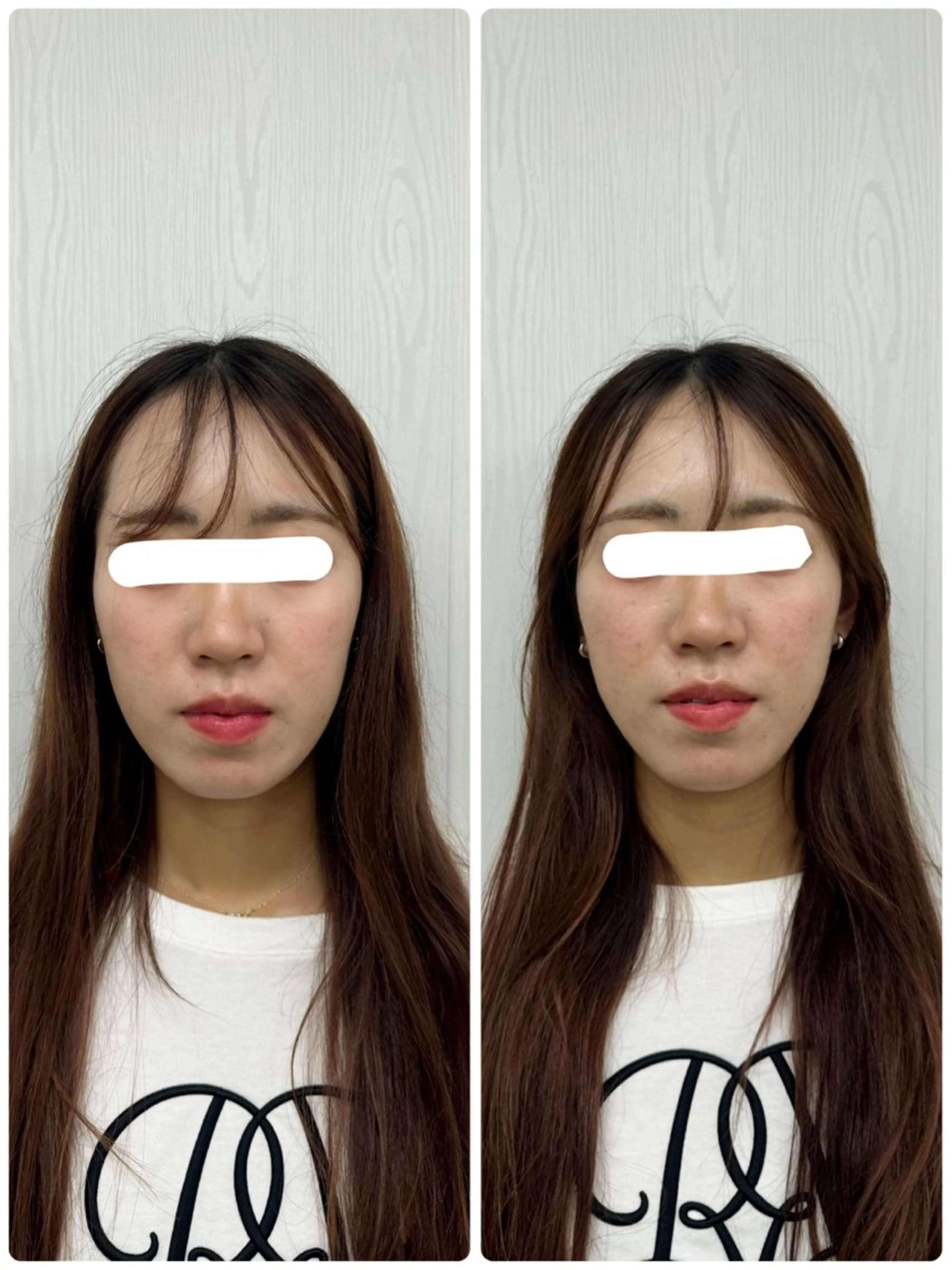 美容鍼×小顔矯正 ×美容整体 浜川泰仁のエステ・リラクイメージ