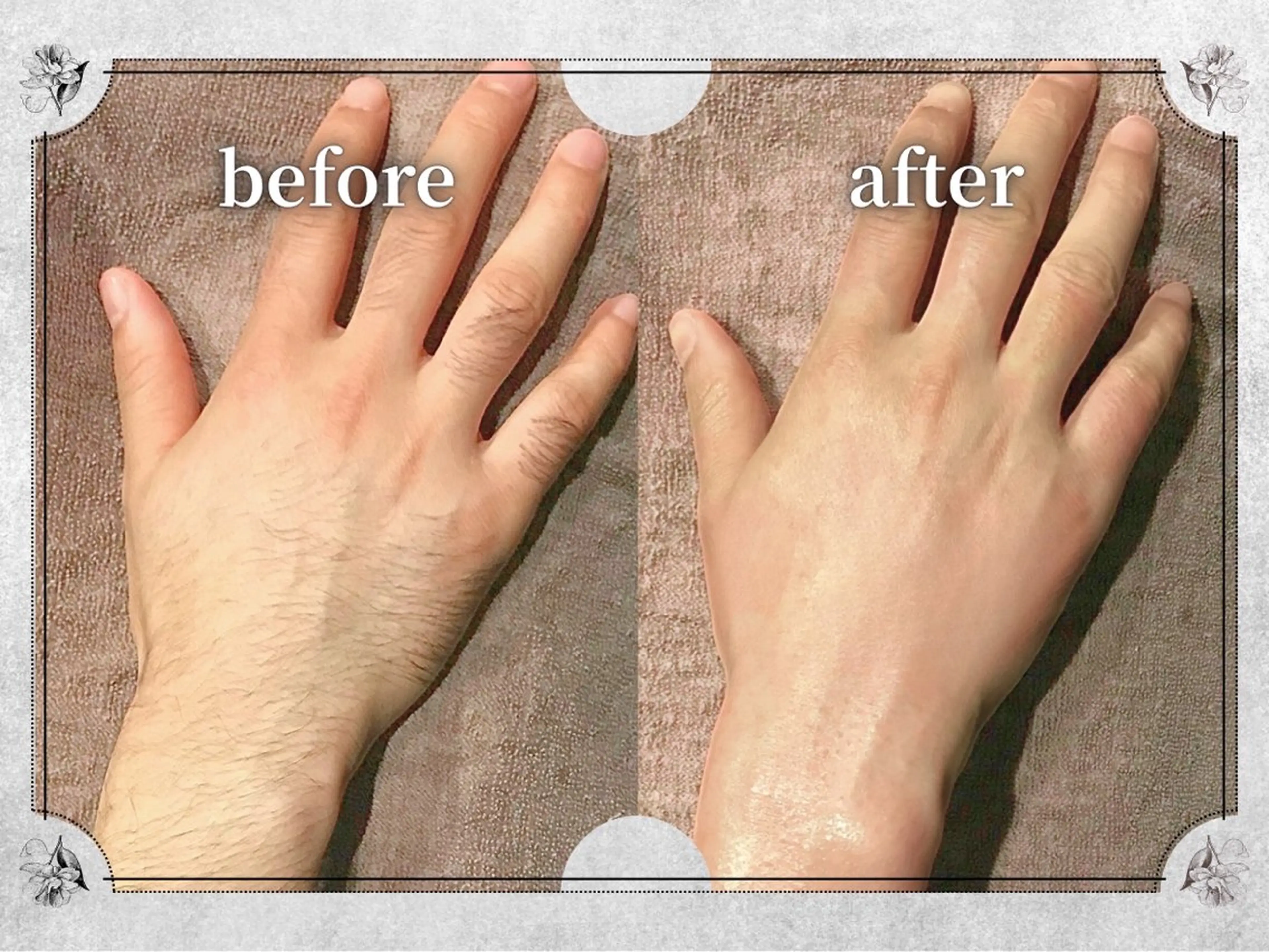 都度払い 脱毛 Lino柏/moeのエステ・リラクイメージ