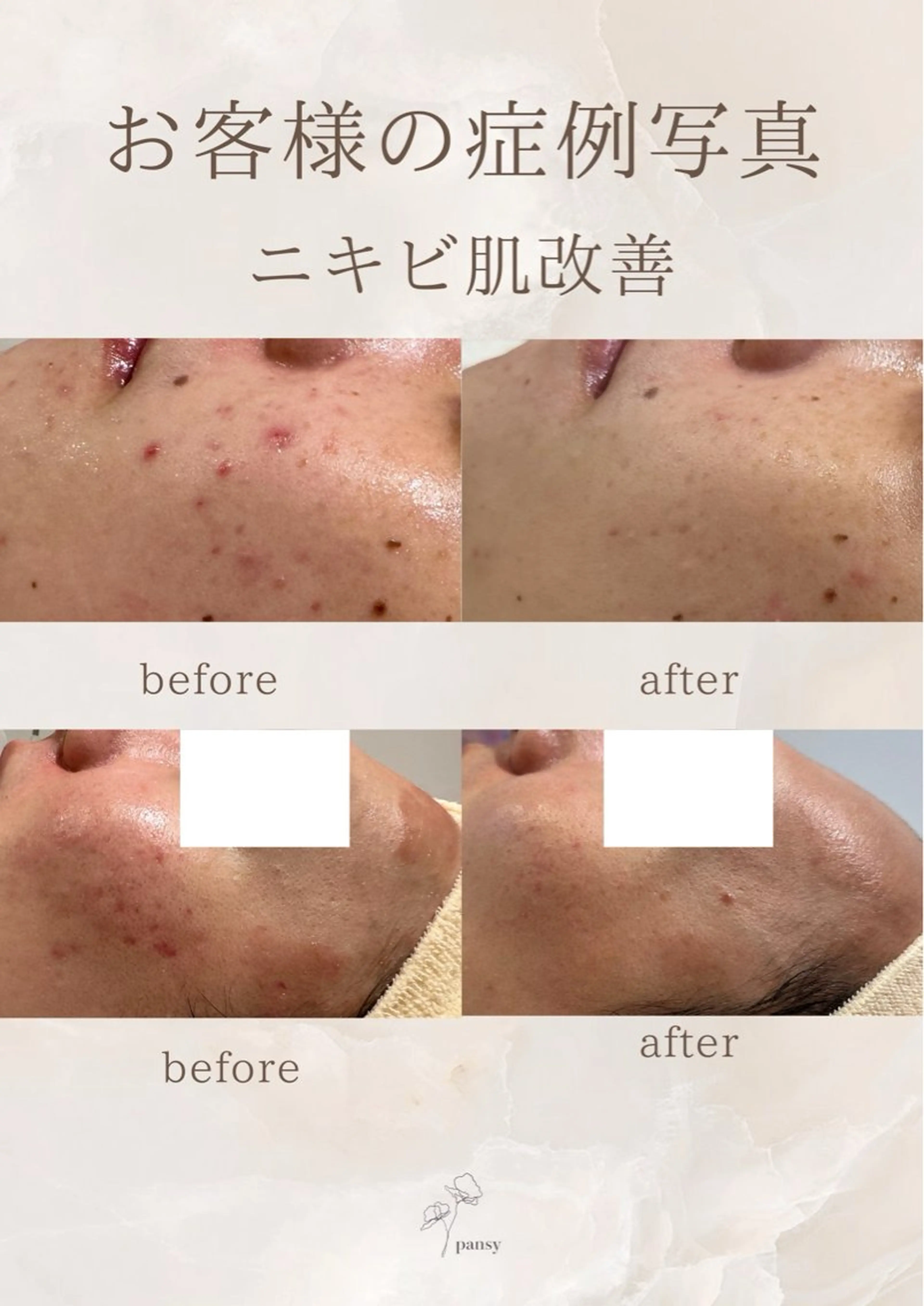 エステ pansy フェイシャルエステのエステ・リラクイメージ