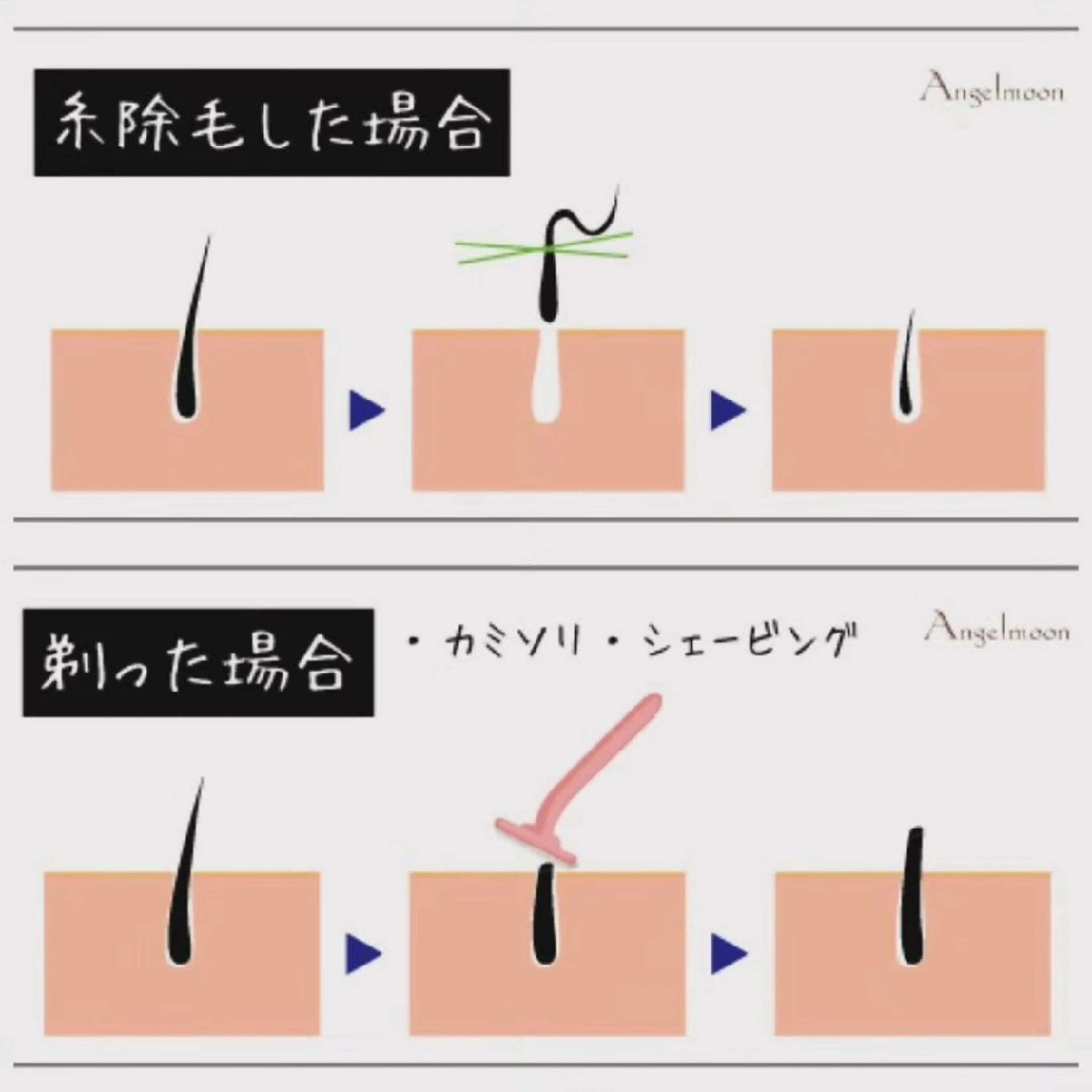 感動レベル🎉【お肌つるつる糸で顔脱毛* エイジングケアコース】うぶ毛✨ひげ✨ボサボサ眉毛✨化粧ノリアップ‼️の写真