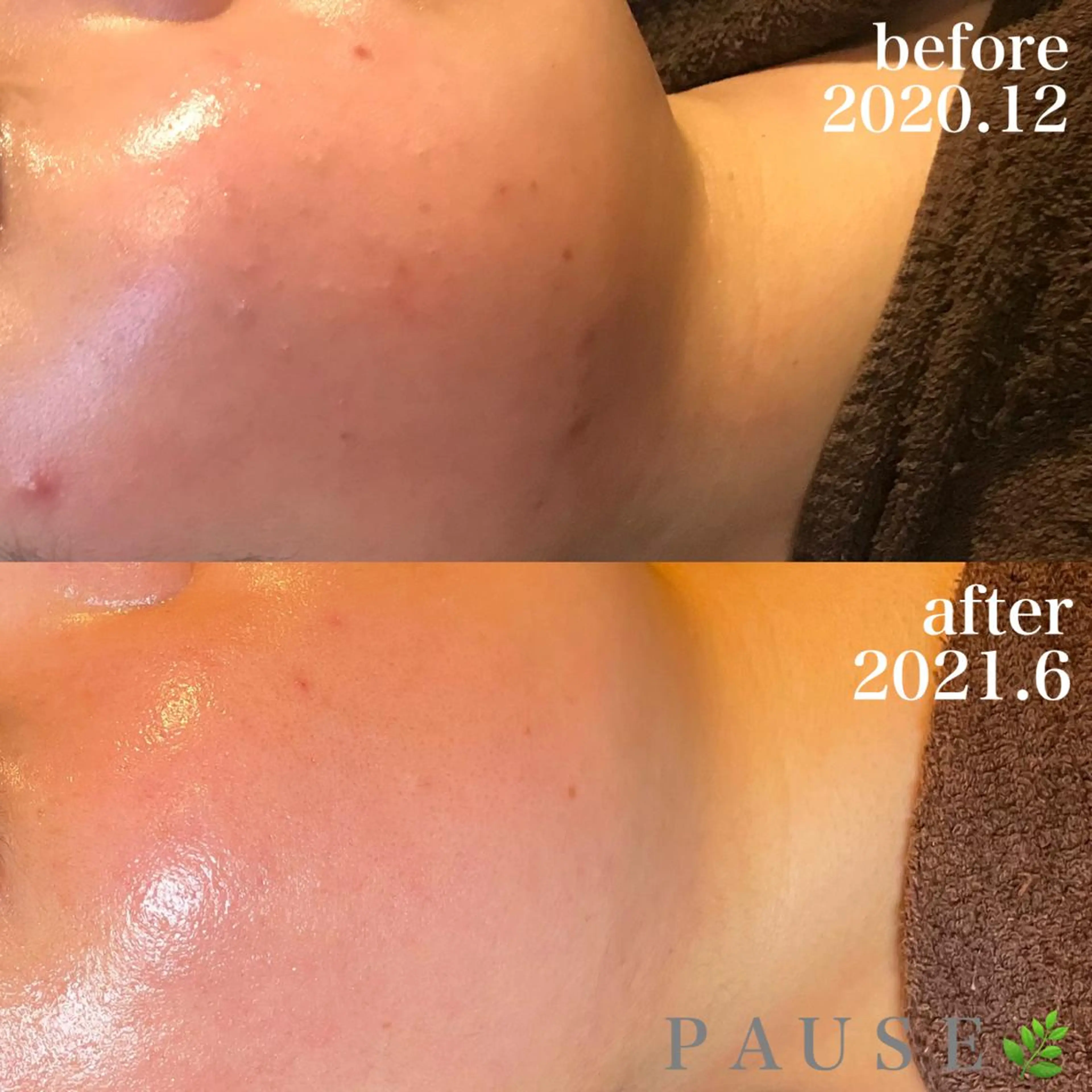 エステ 浜野 恵美のエステ・リラクイメージ