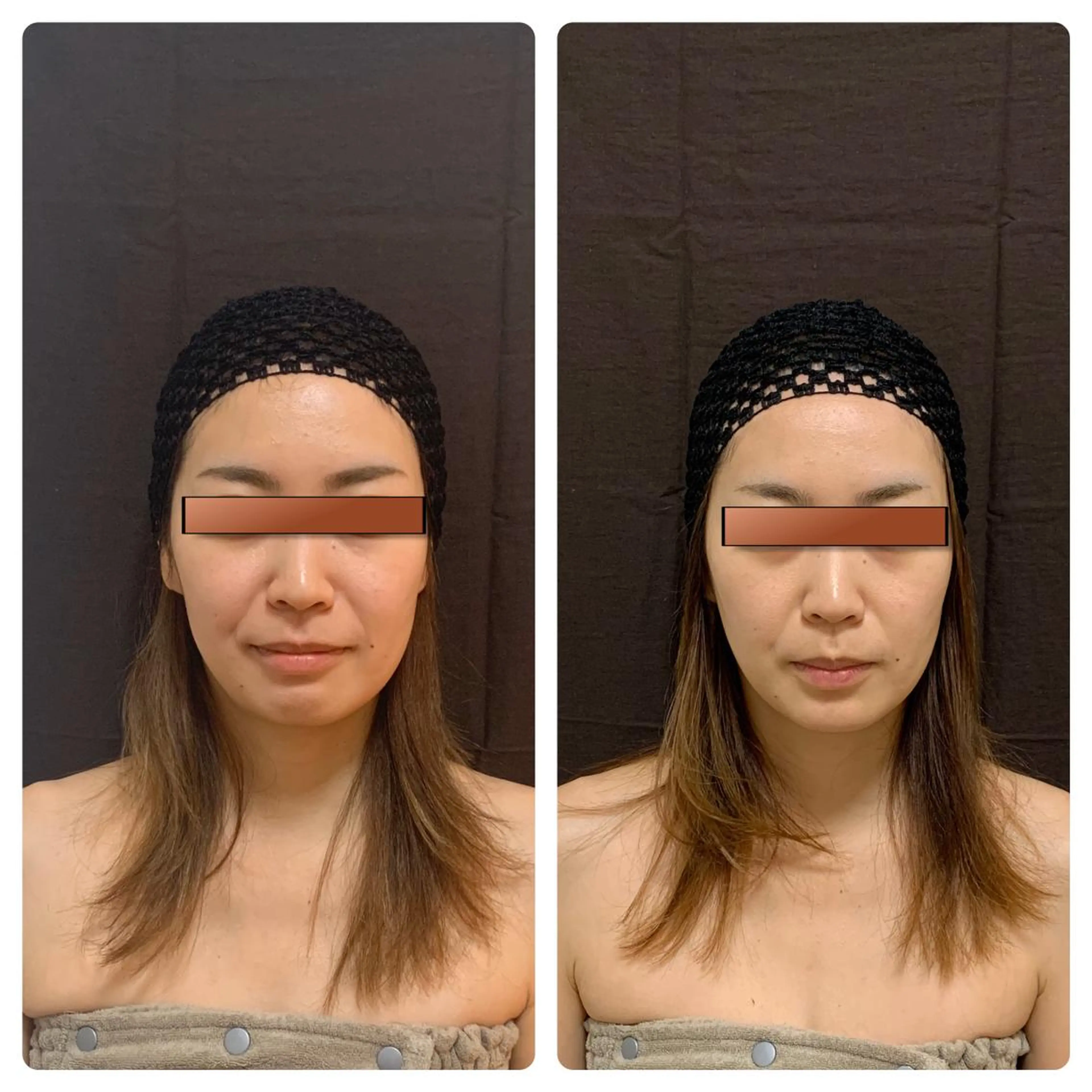 あるる所属・韓国式小顔矯正 担当ゆいのエステ・リラクイメージ