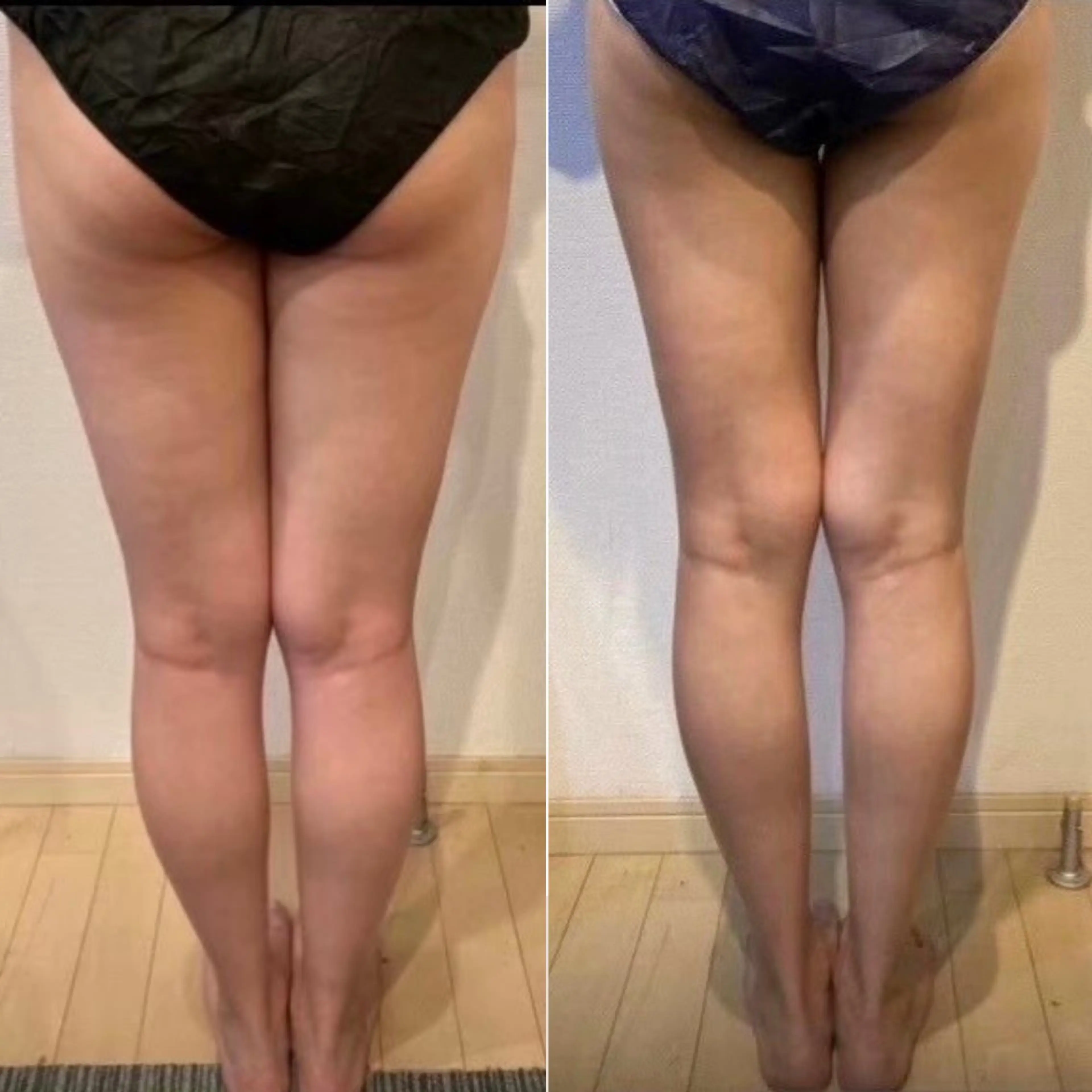 🔥美脚革命（マシン✖️ハンド）【下半身集中ダイエット】気になる足をほっそり🦵60分※メニュー内容は下記をご覧下さいの写真