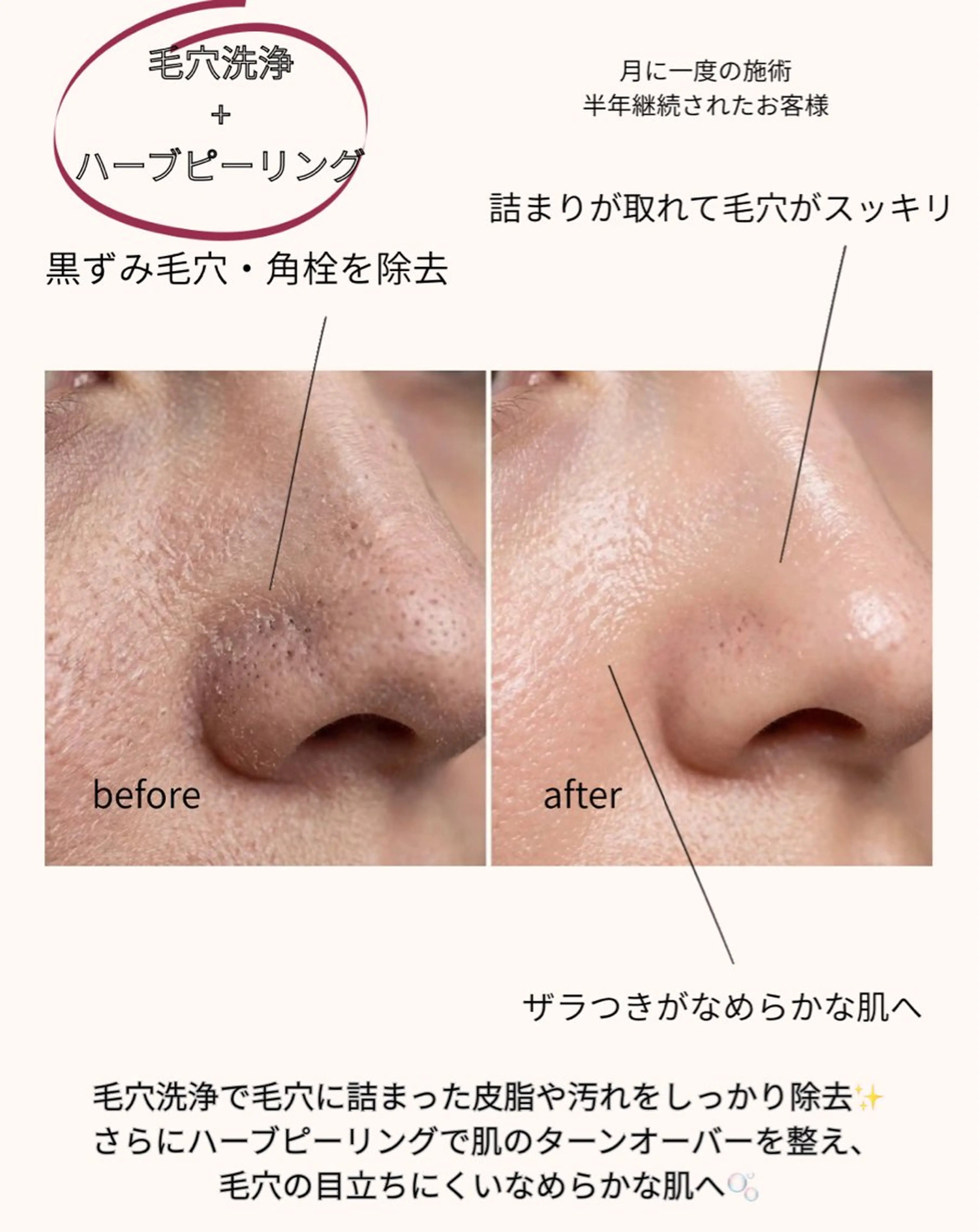 その他 肌質改善サロン réposのその他イメージ