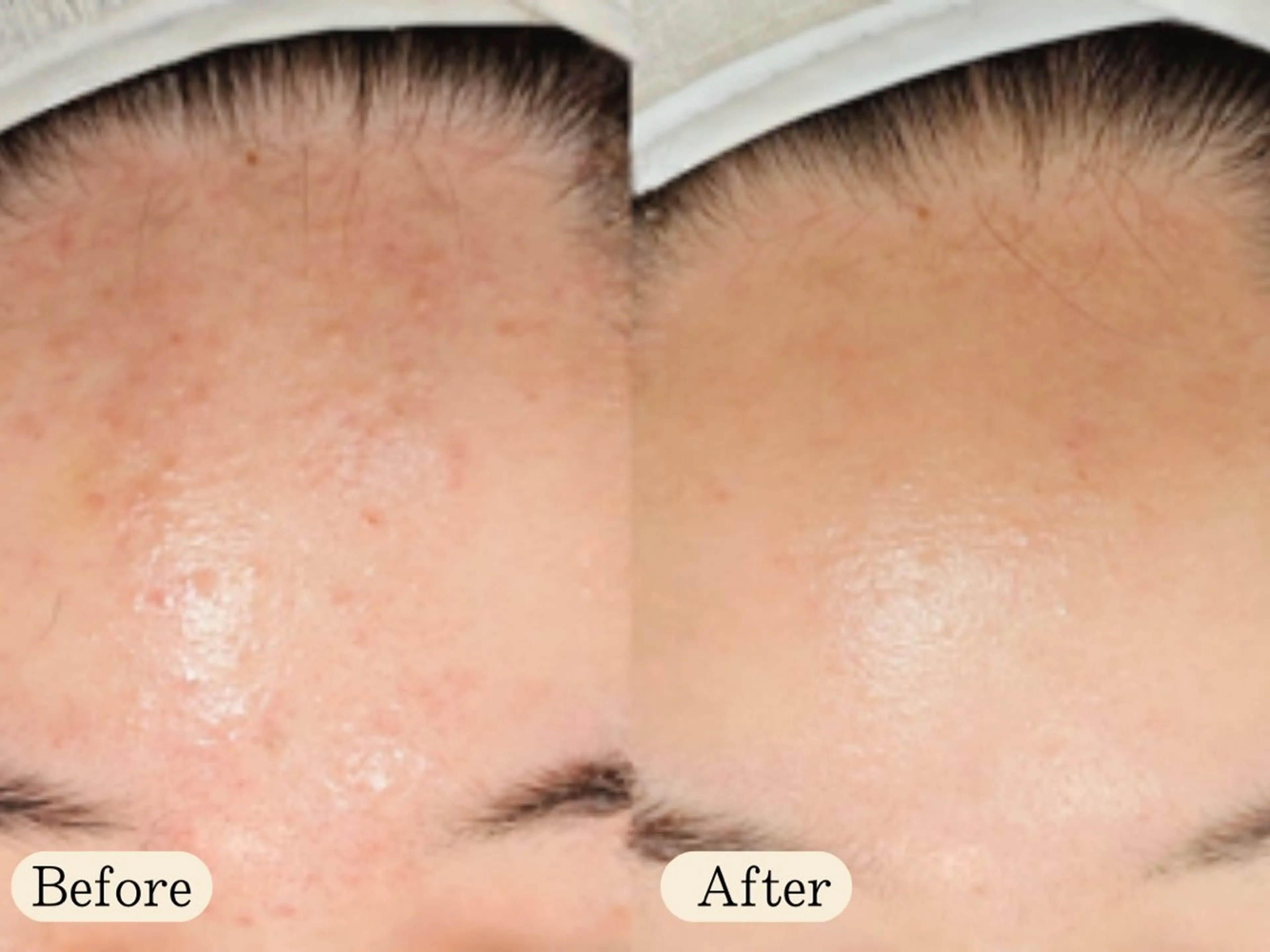 UI LANIのエステ・リラクイメージ