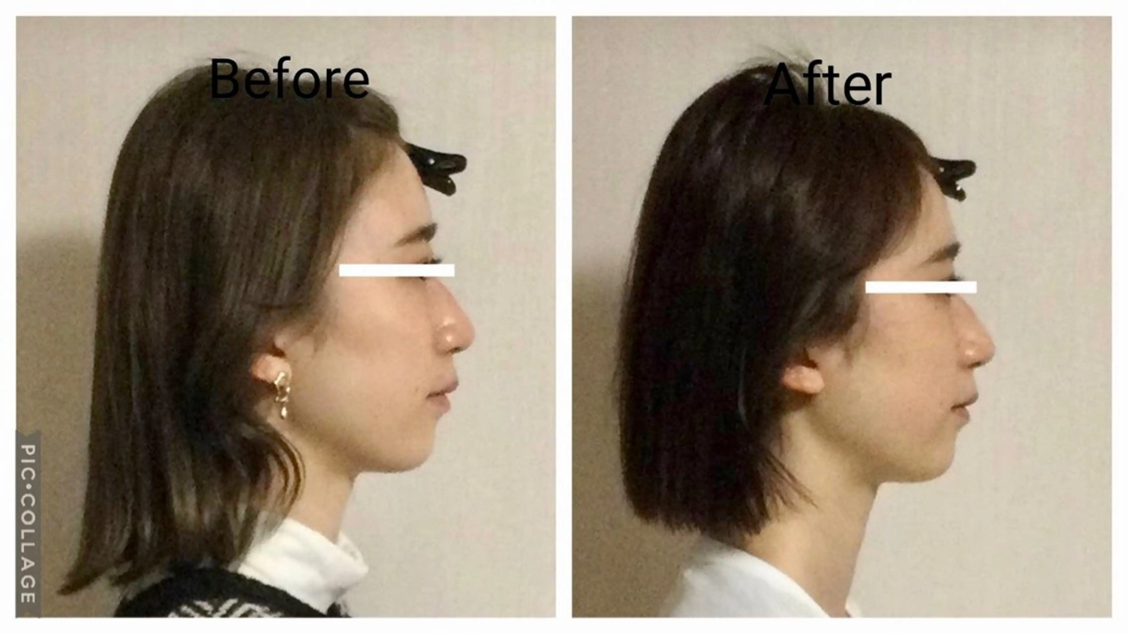 エステ リラク 小顔矯正Sho  FaceDesignのエステ・リラクイメージ