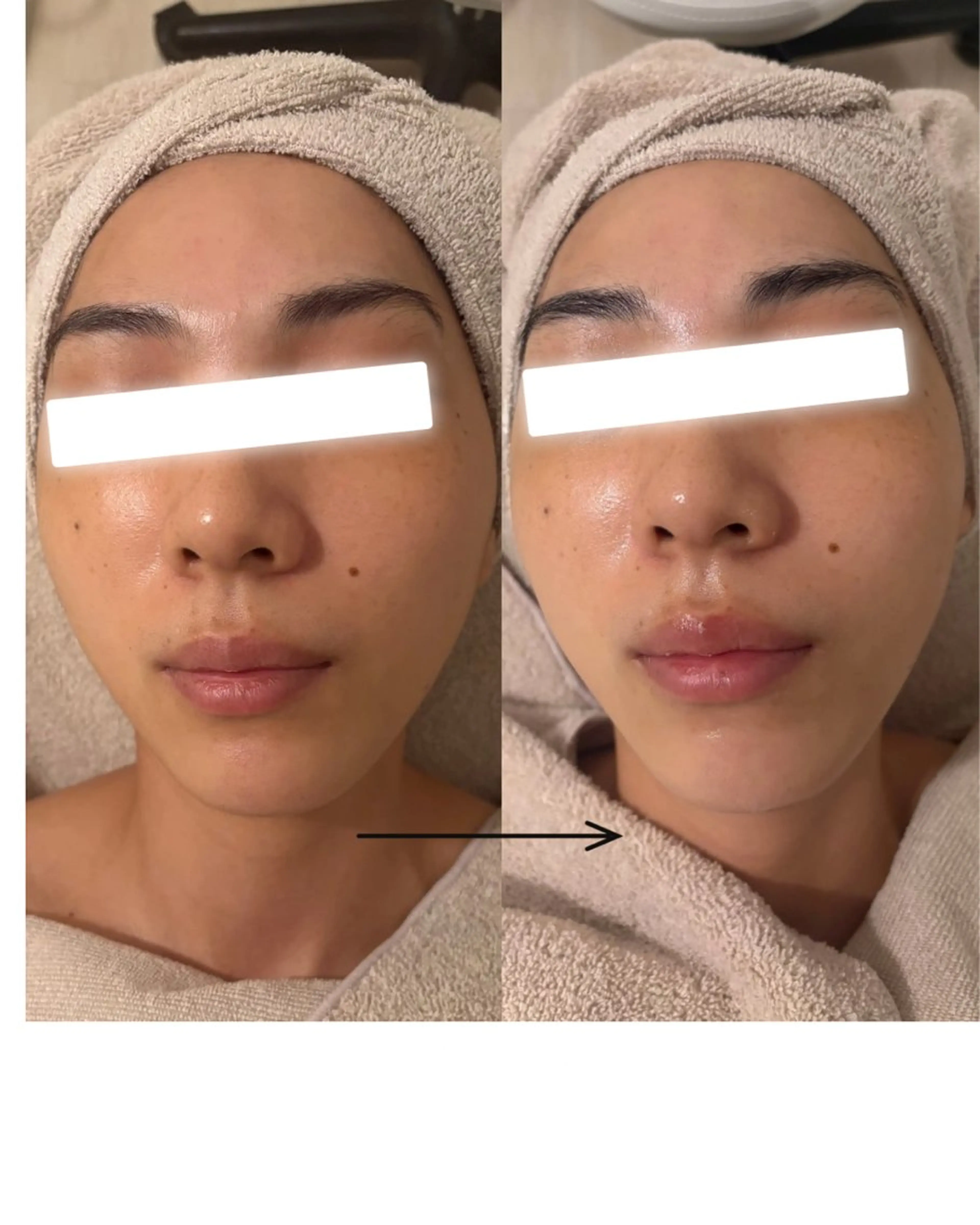 UEDA | POLA 天王寺のエステ・リラクイメージ