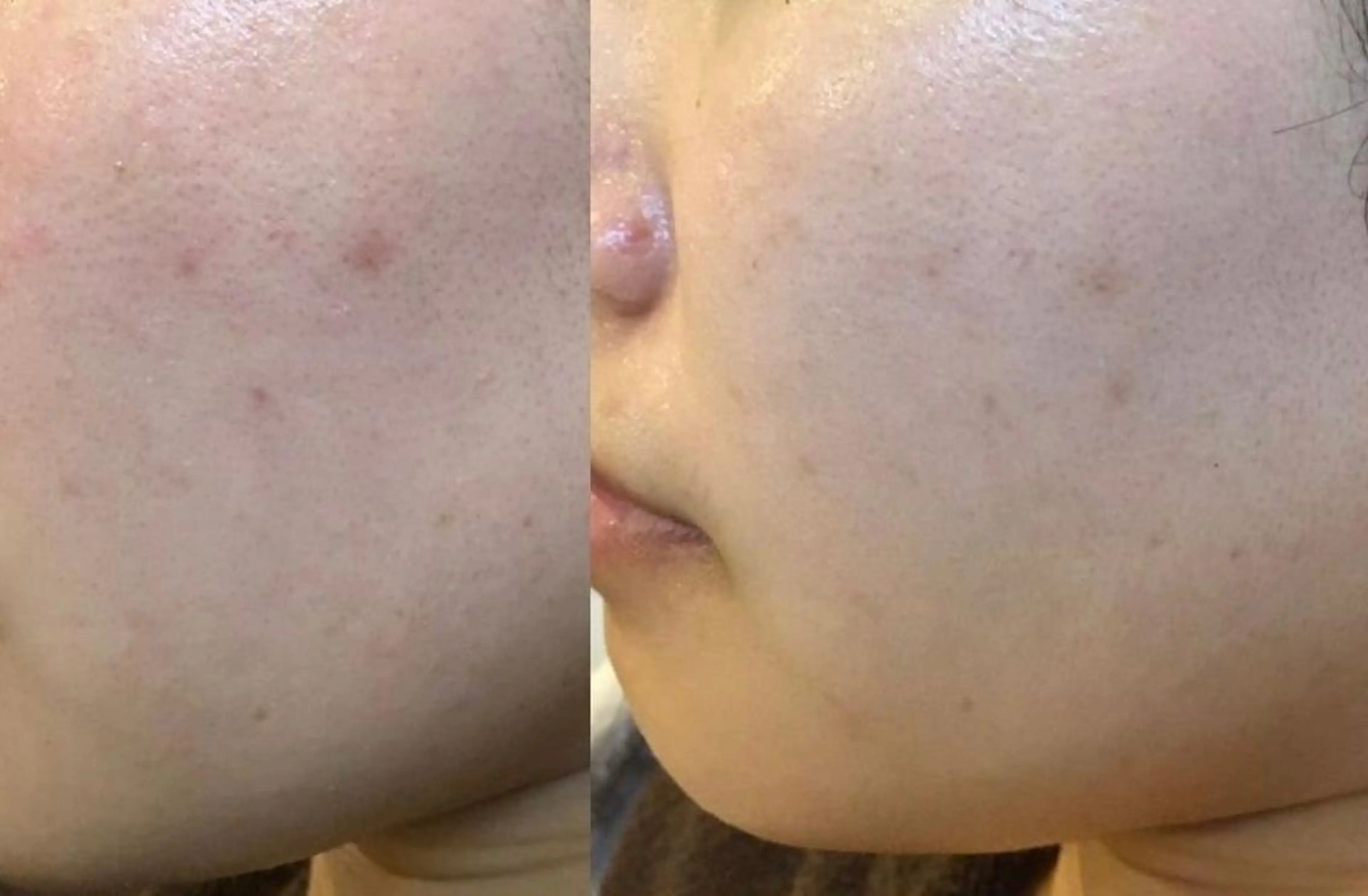 朝重い人専用 肩甲骨調整のエステ・リラクイメージ