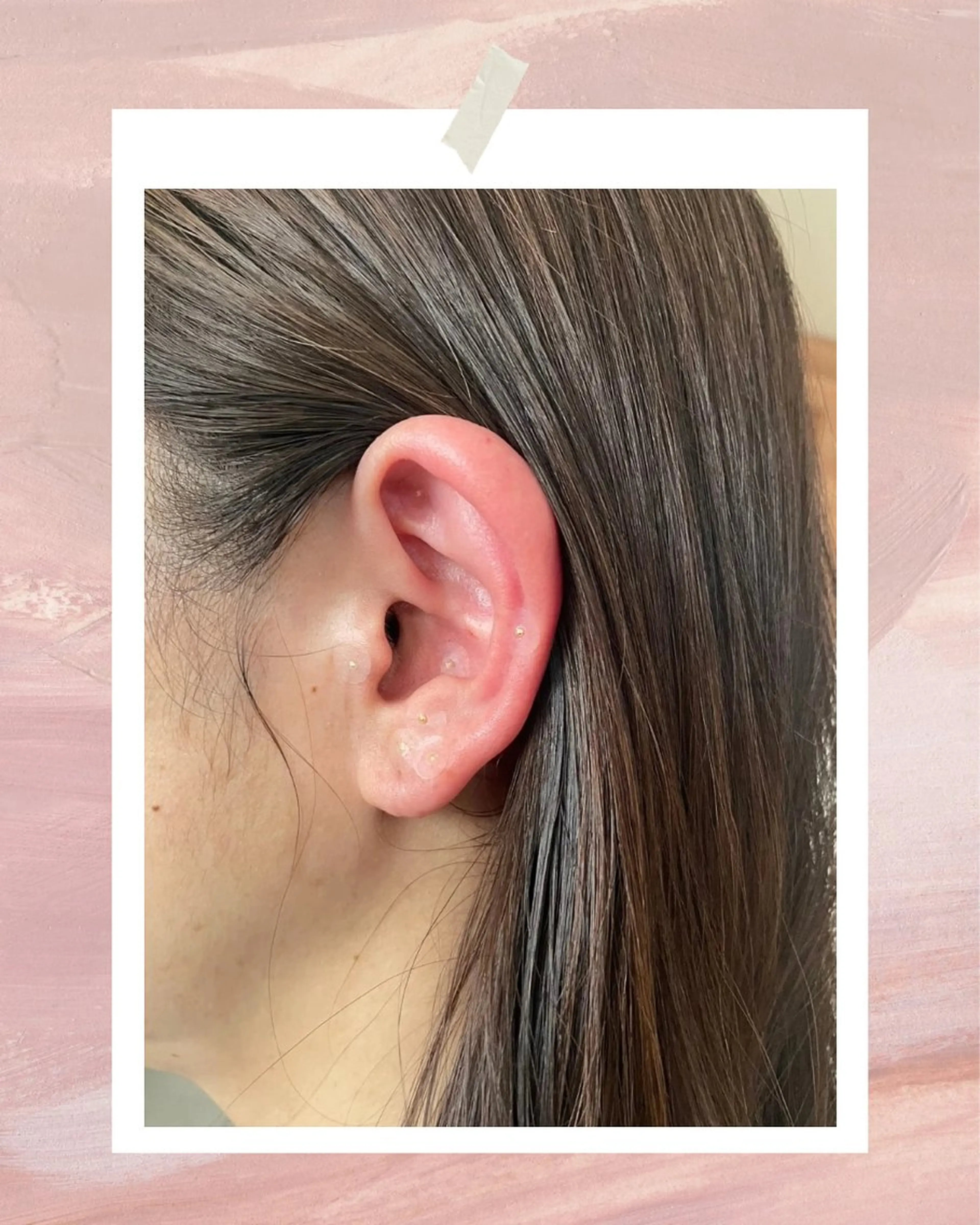 mimine エメラルド式耳つぼのその他イメージ